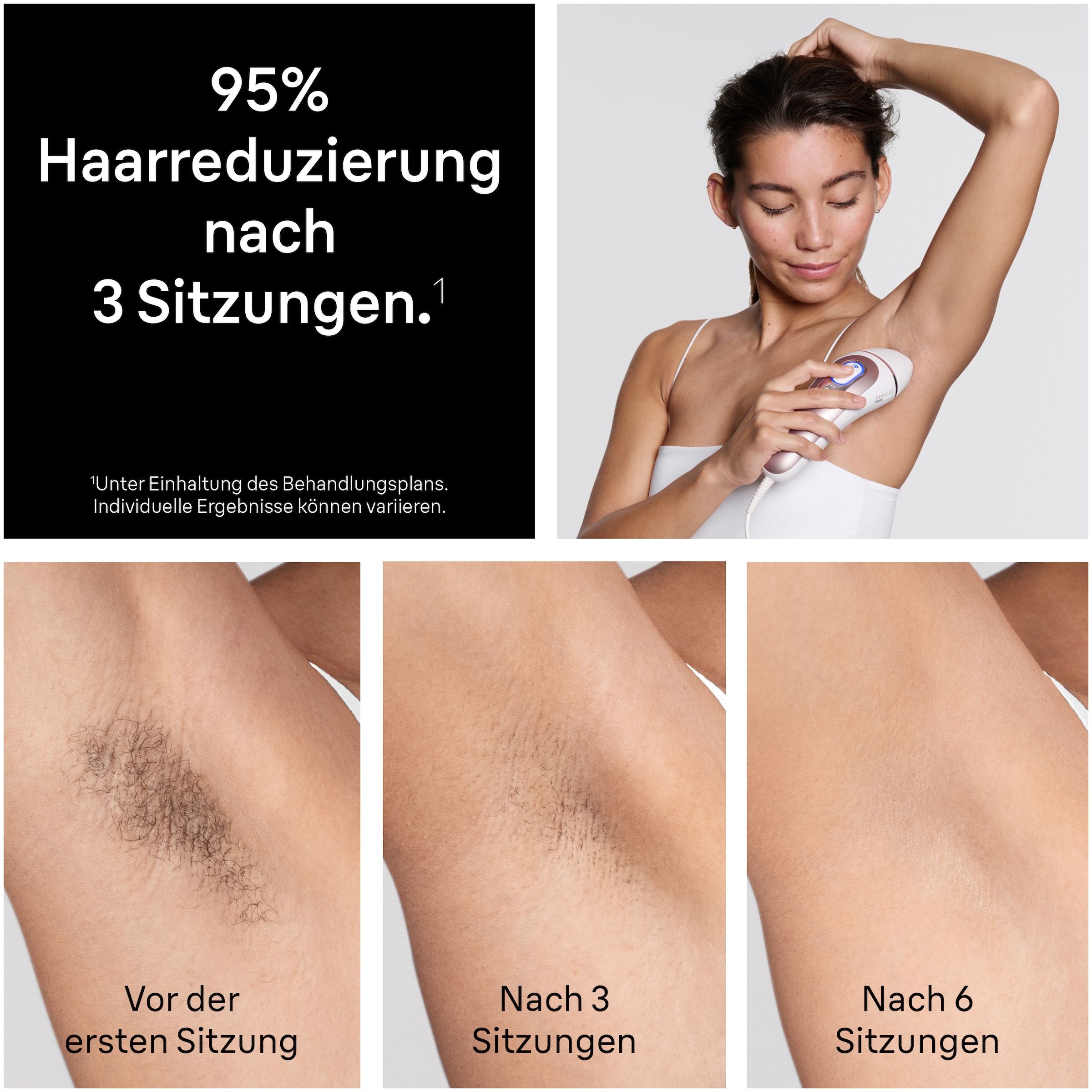 Braun IPL-Haarentferner »Skin i-expert Pro IPL PL7431« 400.000 Lichtimpulse mit kostenloser App, 4 smarte Aufsätze, Tasche