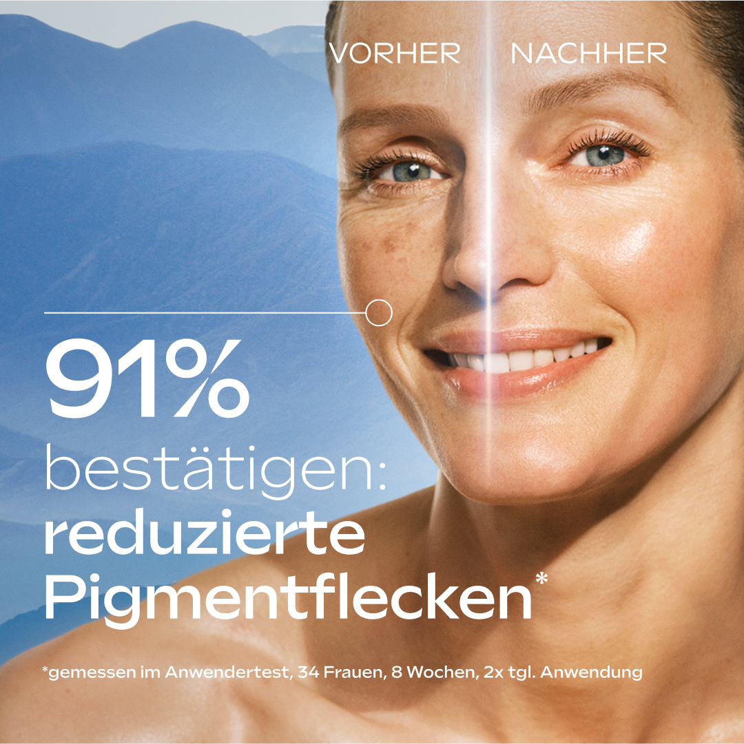 WELEDA Anti-Falten-Serum »Anti-Pigmentflecken Bright Serum«