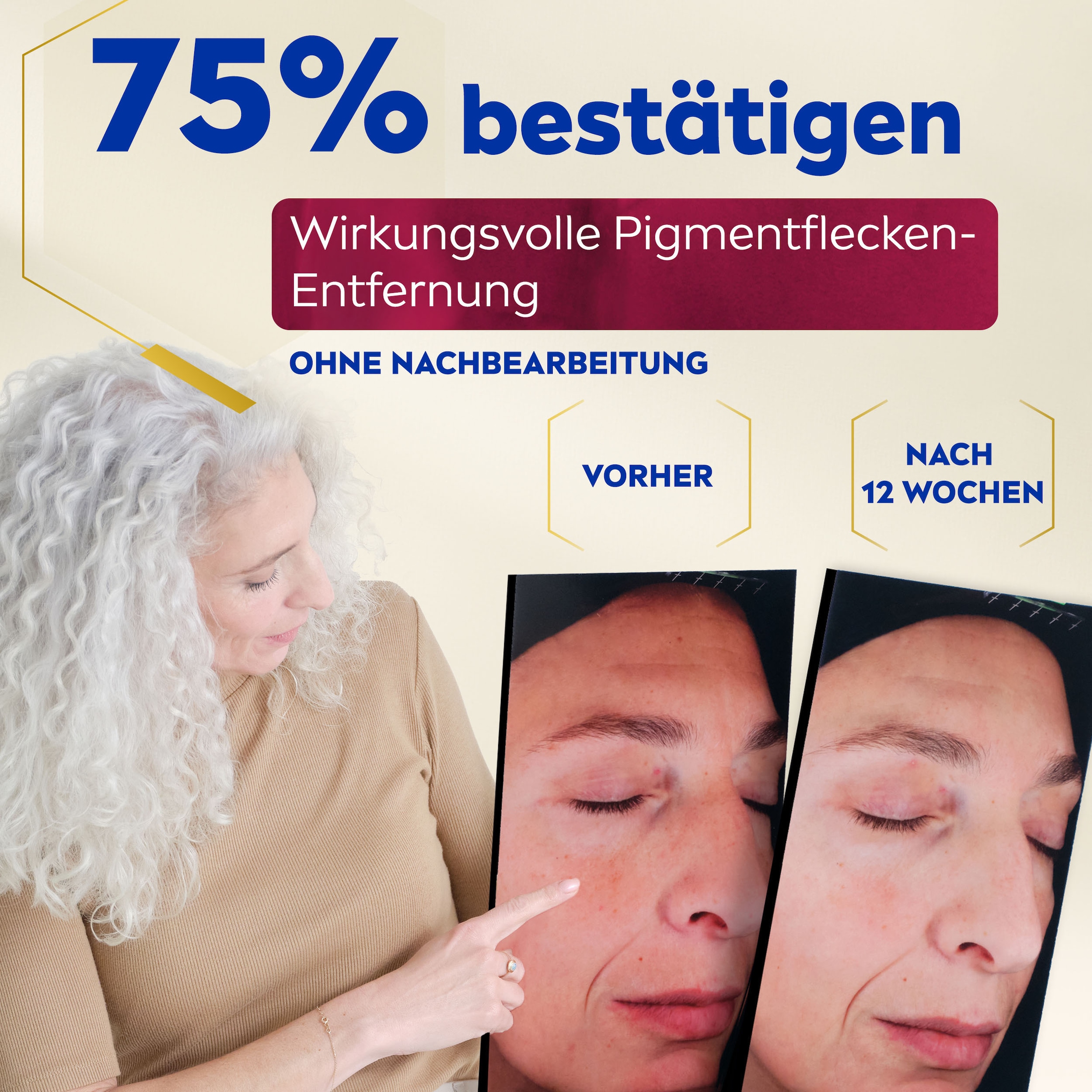 Nivea Gesichtsserum »LUMINOUS630 ANTI-PIGMENTFLECKEN Intensiv-Serum«, Mit Thiamidol und Hyaluronsäure, auch für sensible Haut geeignet.