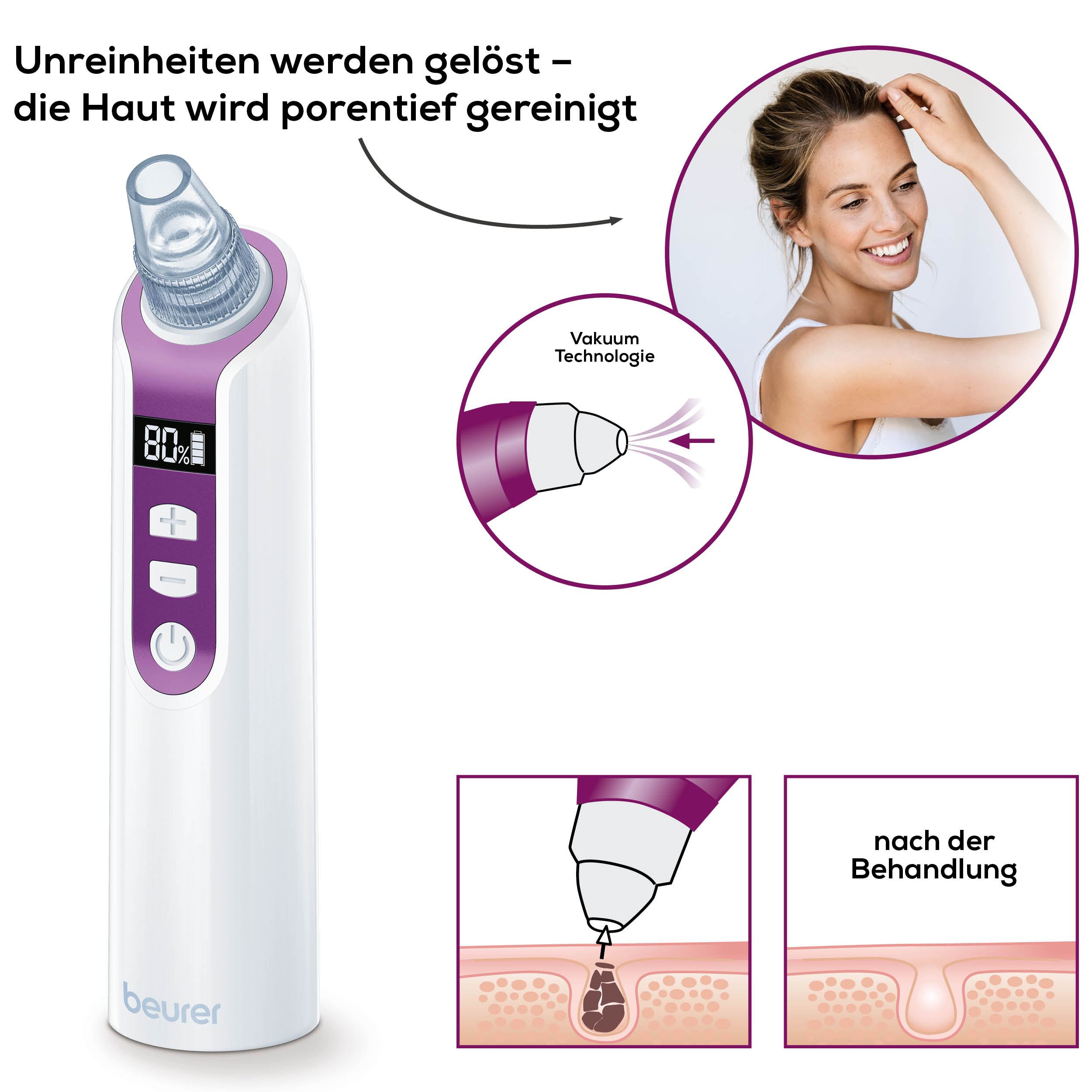 Thumbnail - BEURER Porenreiniger "FC 41 Mitesserentferner durch Vakuumtechnologie" 5 Intensitätsstufen und 3 Aufsätze für eine indiv...