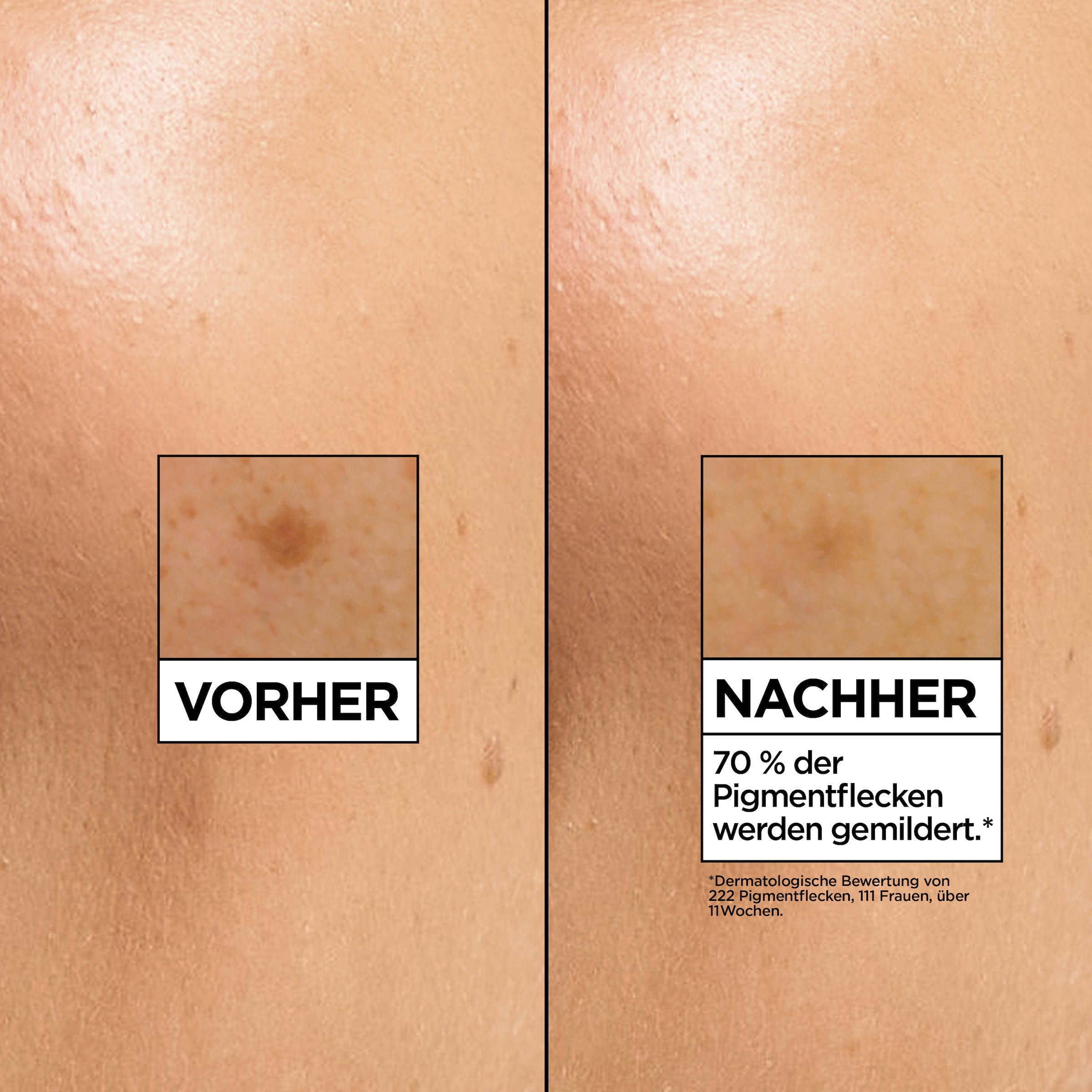GARNIER Gesichtsserum »SkinActive Vitamin C« wirkt Pigmentflecken entgegen, die Haut wird glatter