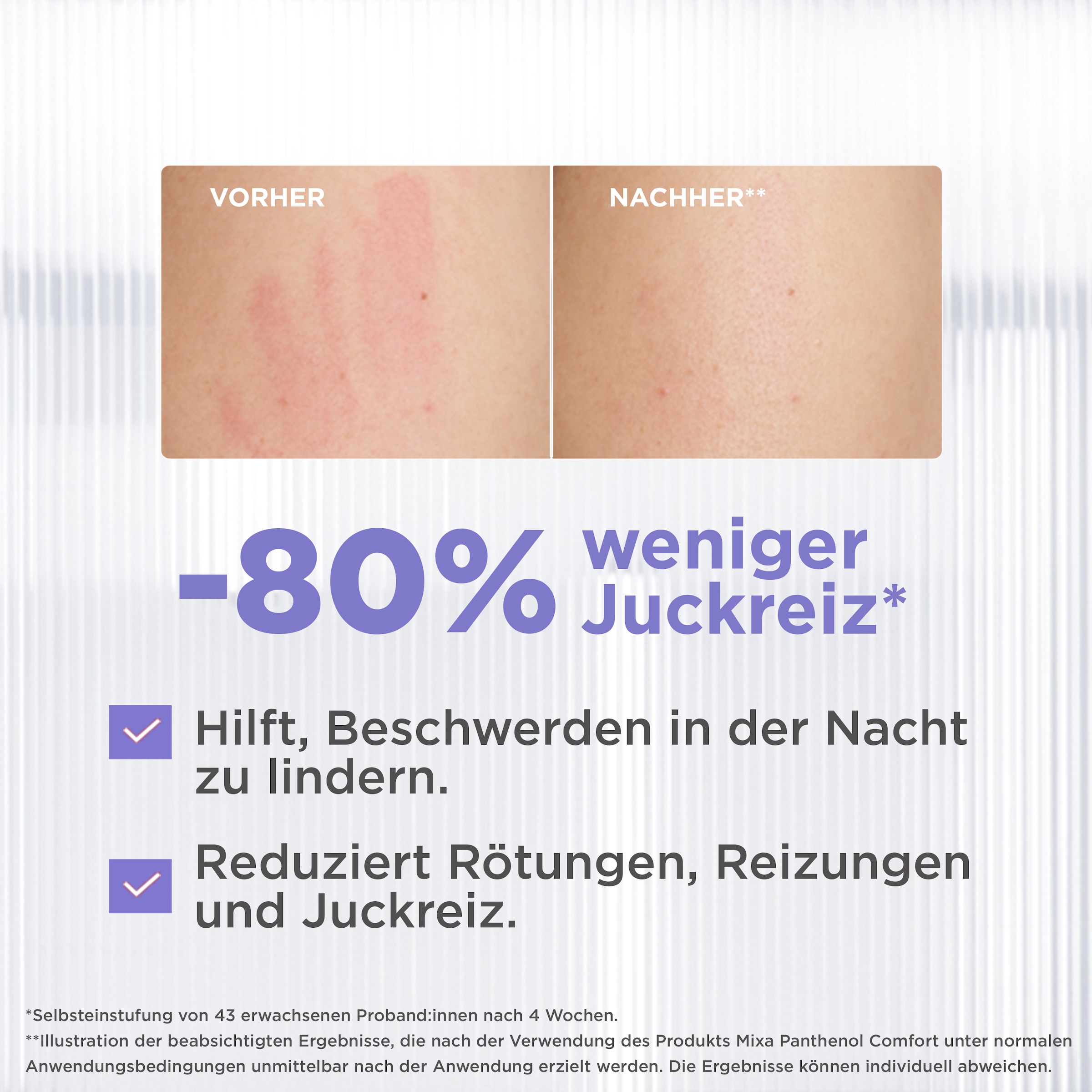 Mixa Körpercreme »MIXA PANTHENOL COMFORT HAUTBERUHIGENDE CREME« sanfte Pflege, hilft bei zu Neurodermitis neigender Haut, fettet nicht