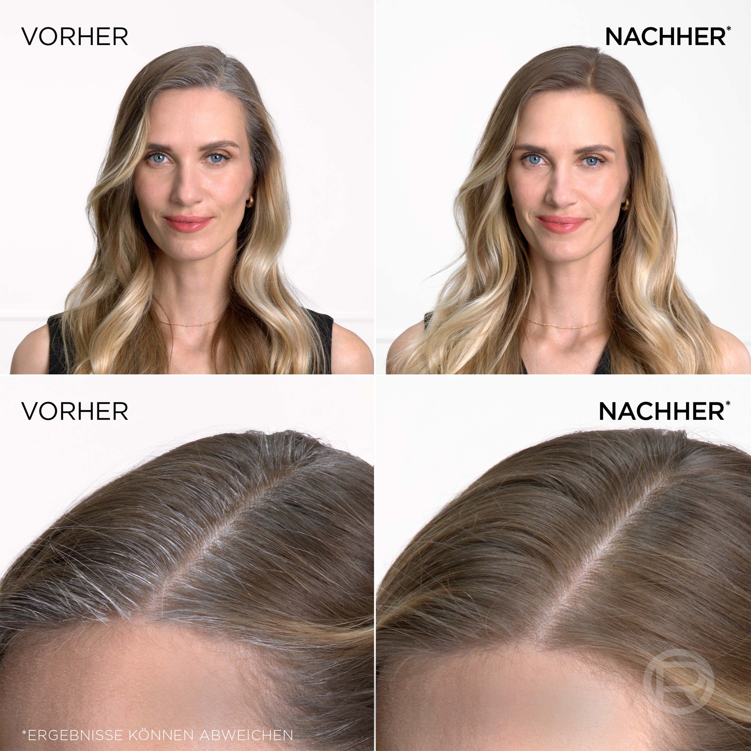 L'ORÉAL PARIS Haaransatz-Spray »MAGIC RETOUCH«