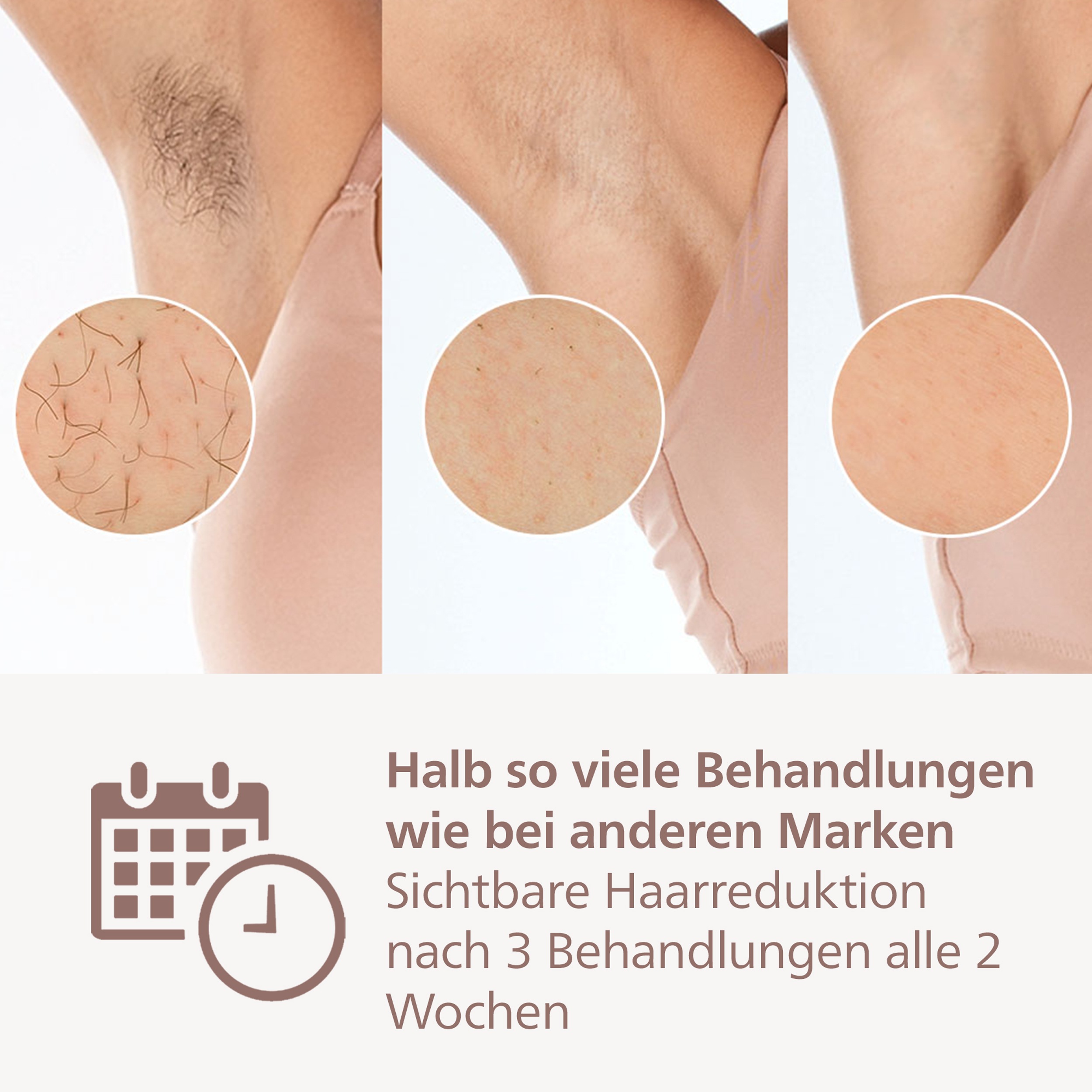 Thumbnail - Philips IPL-Haarentferner "Lumea S9900 BRI951/01" 450.000 Lichtimpulse kabellos, 2 SkinAI Funktionen