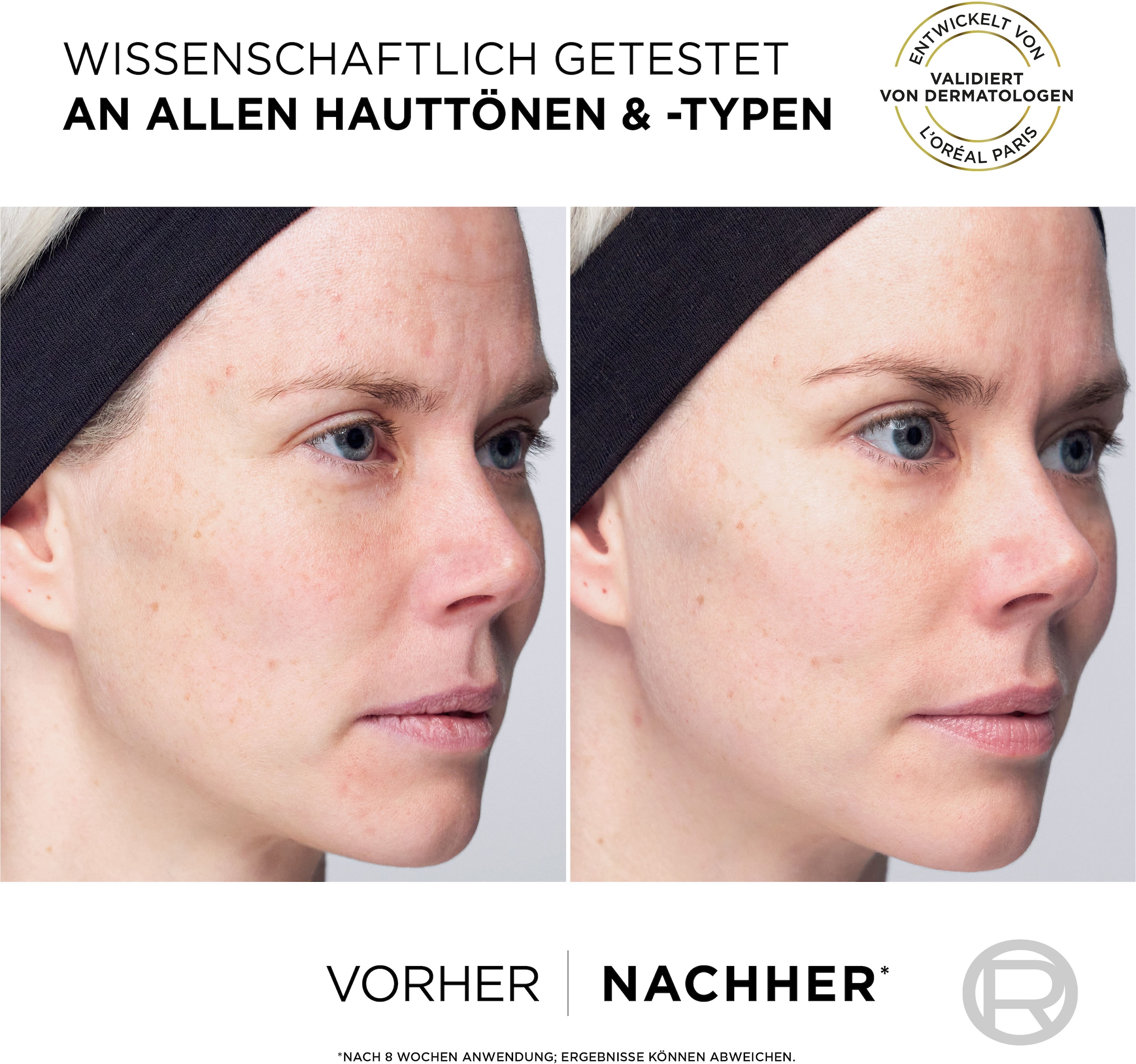 L'ORÉAL PARIS Gesichtsserum »Gesichtsserum mit Vitamin C«, anioxidativ