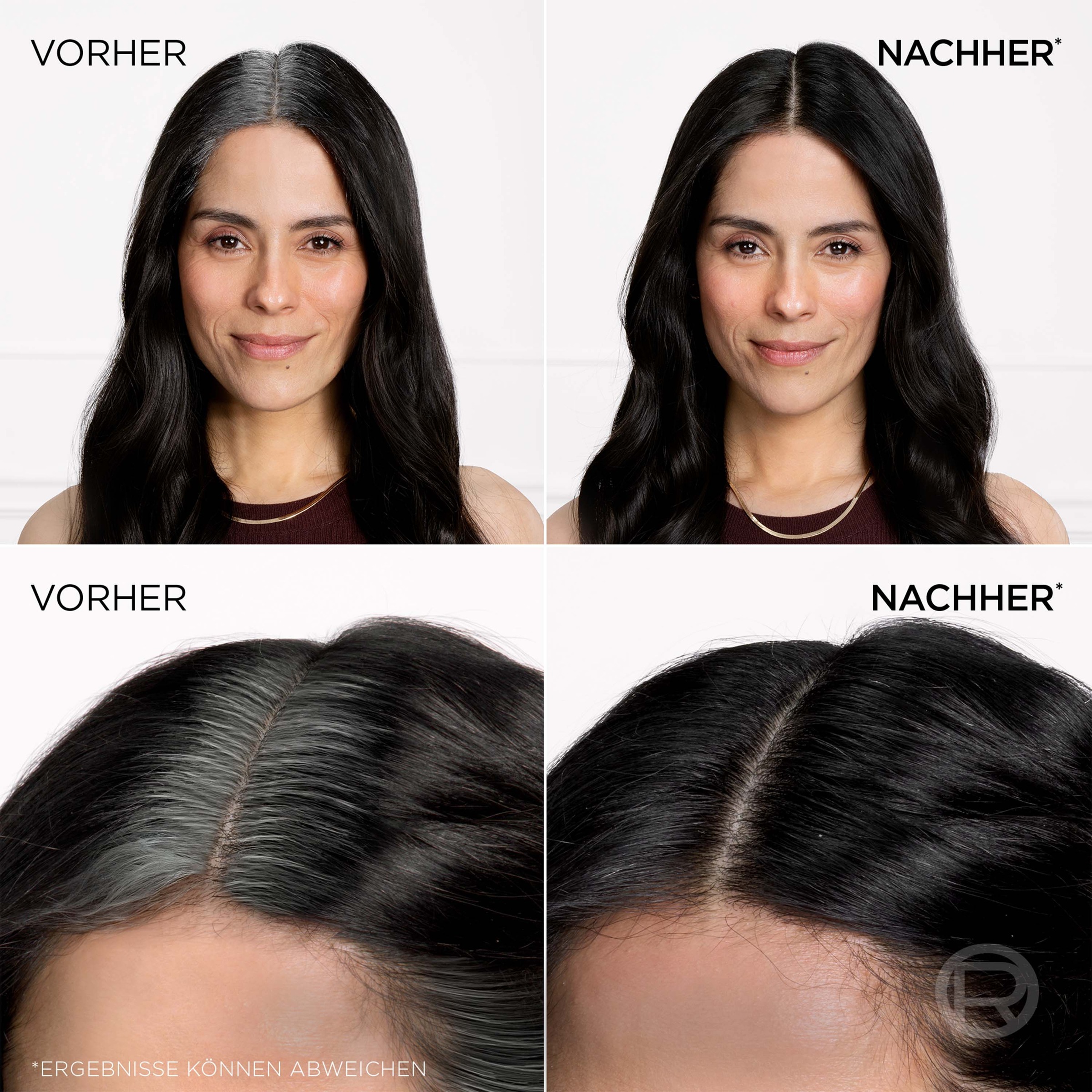 L'ORÉAL PARIS Haaransatz-Spray »MAGIC RETOUCH«