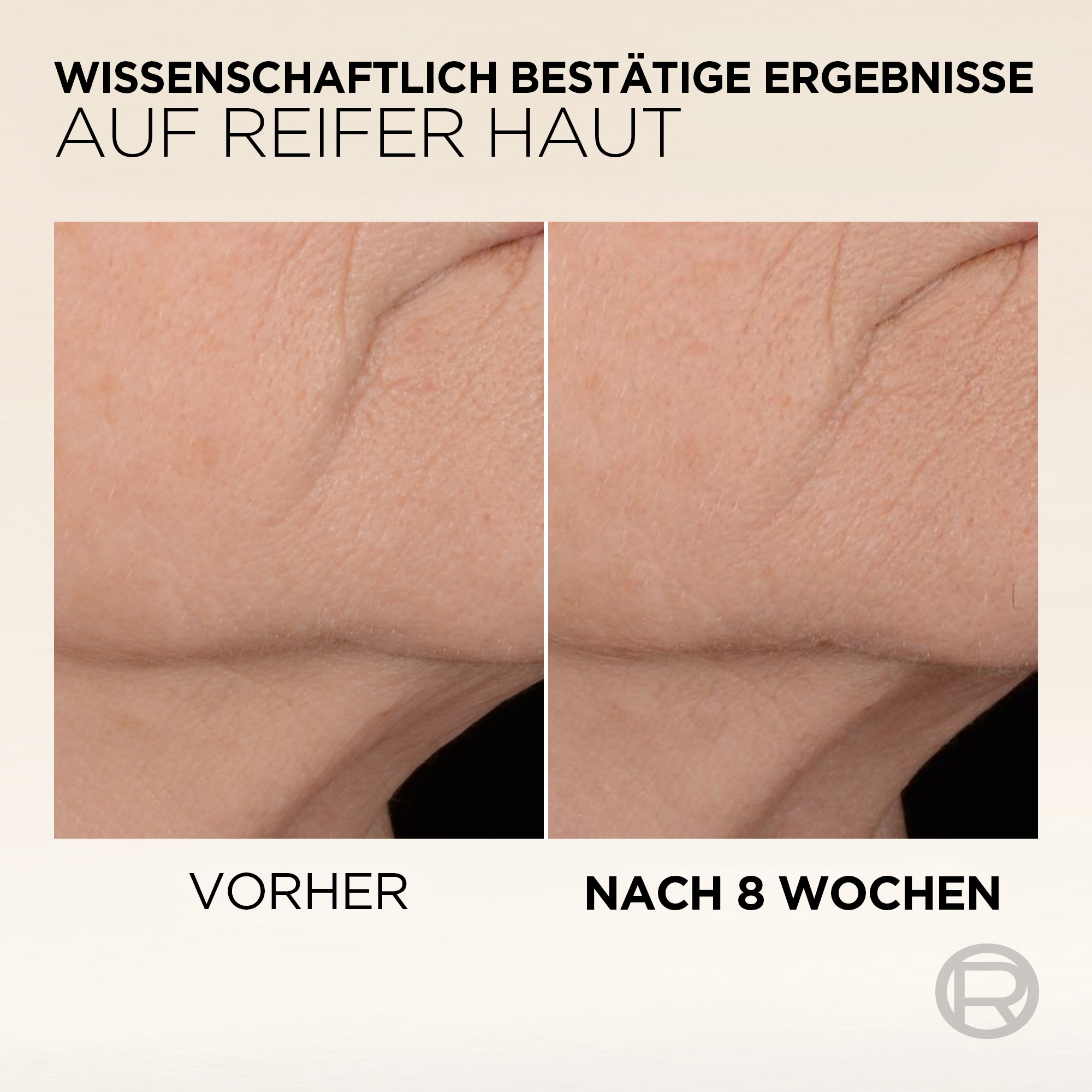 L'ORÉAL PARIS Anti-Falten-Serum »AGE PERFECT MIKRO-KOLLAGEN SERUM«