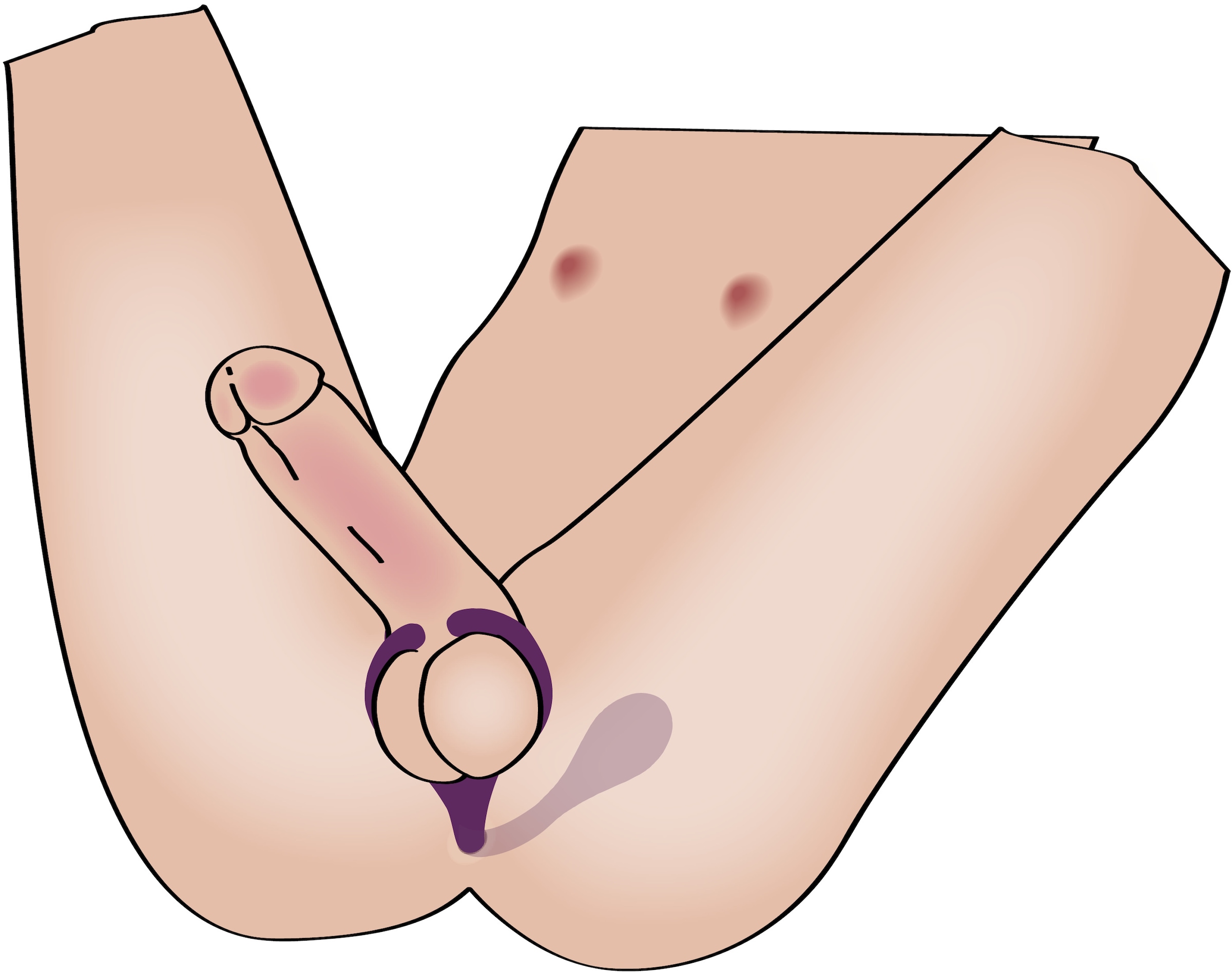 coup!es choice Vibrator »Vibrator Remote Controlled Couple's Vibrator«