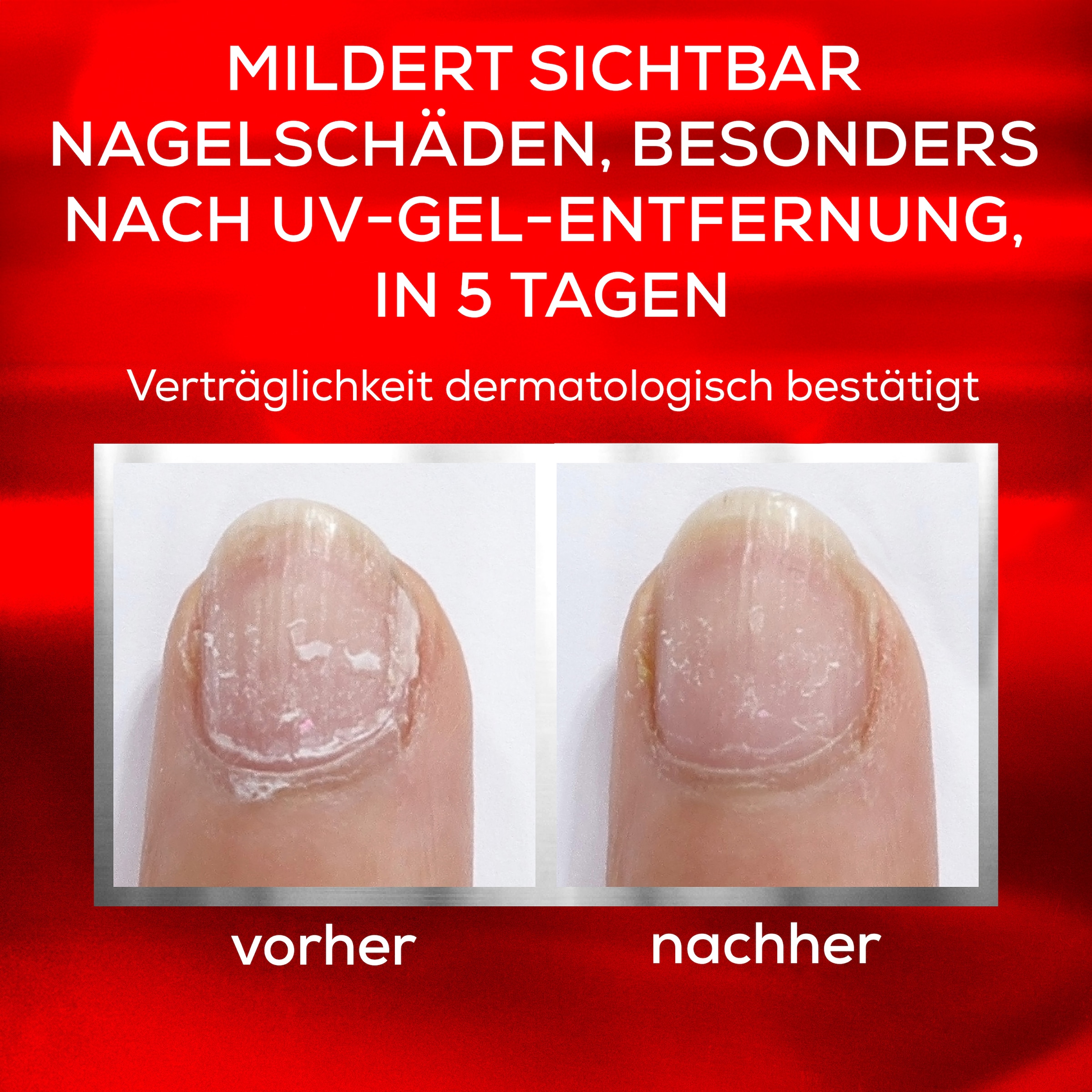 essie Nagelhärter »to the rescue«, mit dreifachem Proteinkomplex für starke Nägel.