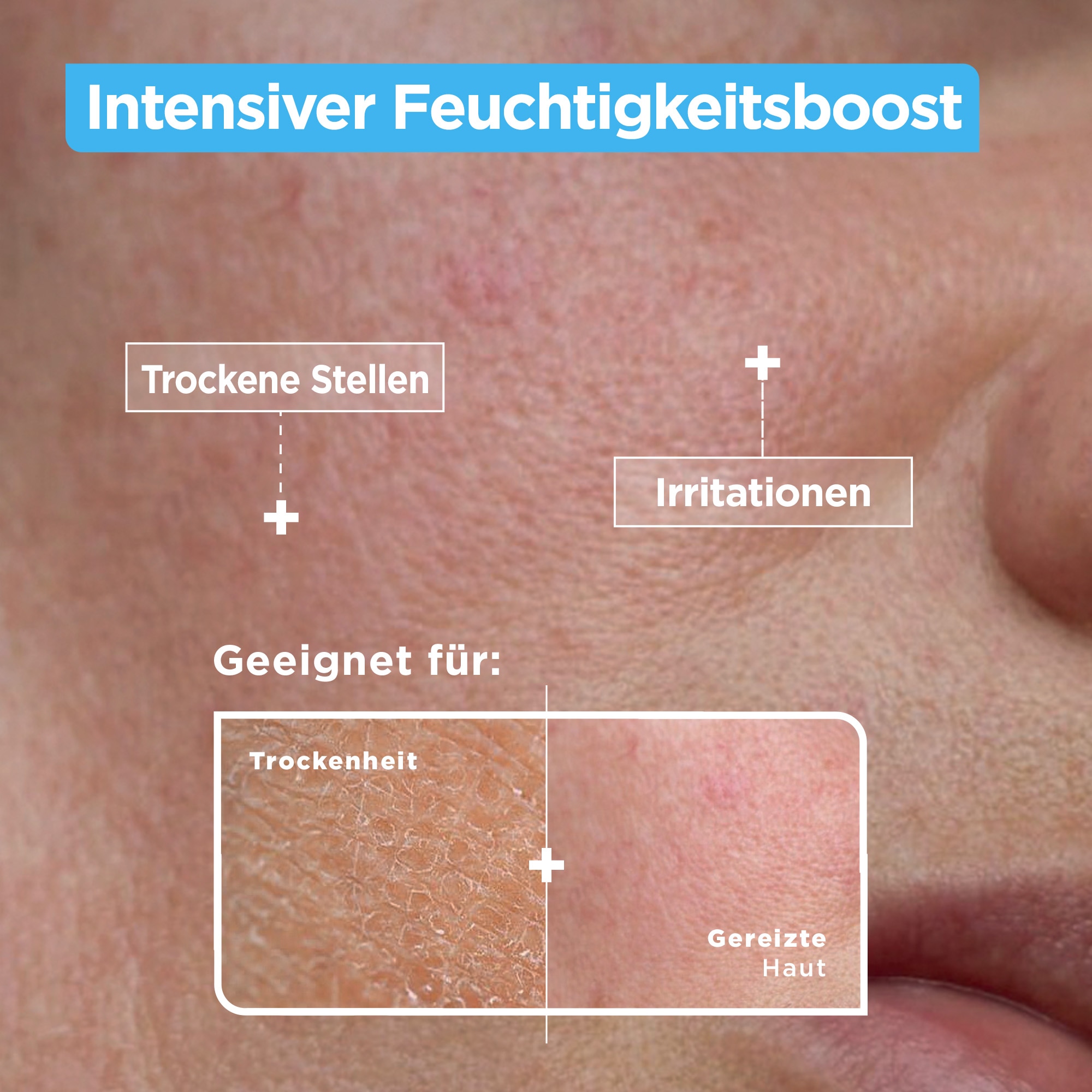 Mixa Gesichtsserum »Mixa Anti-Trockenheit Serum«, mit hoher Wirksamkeit