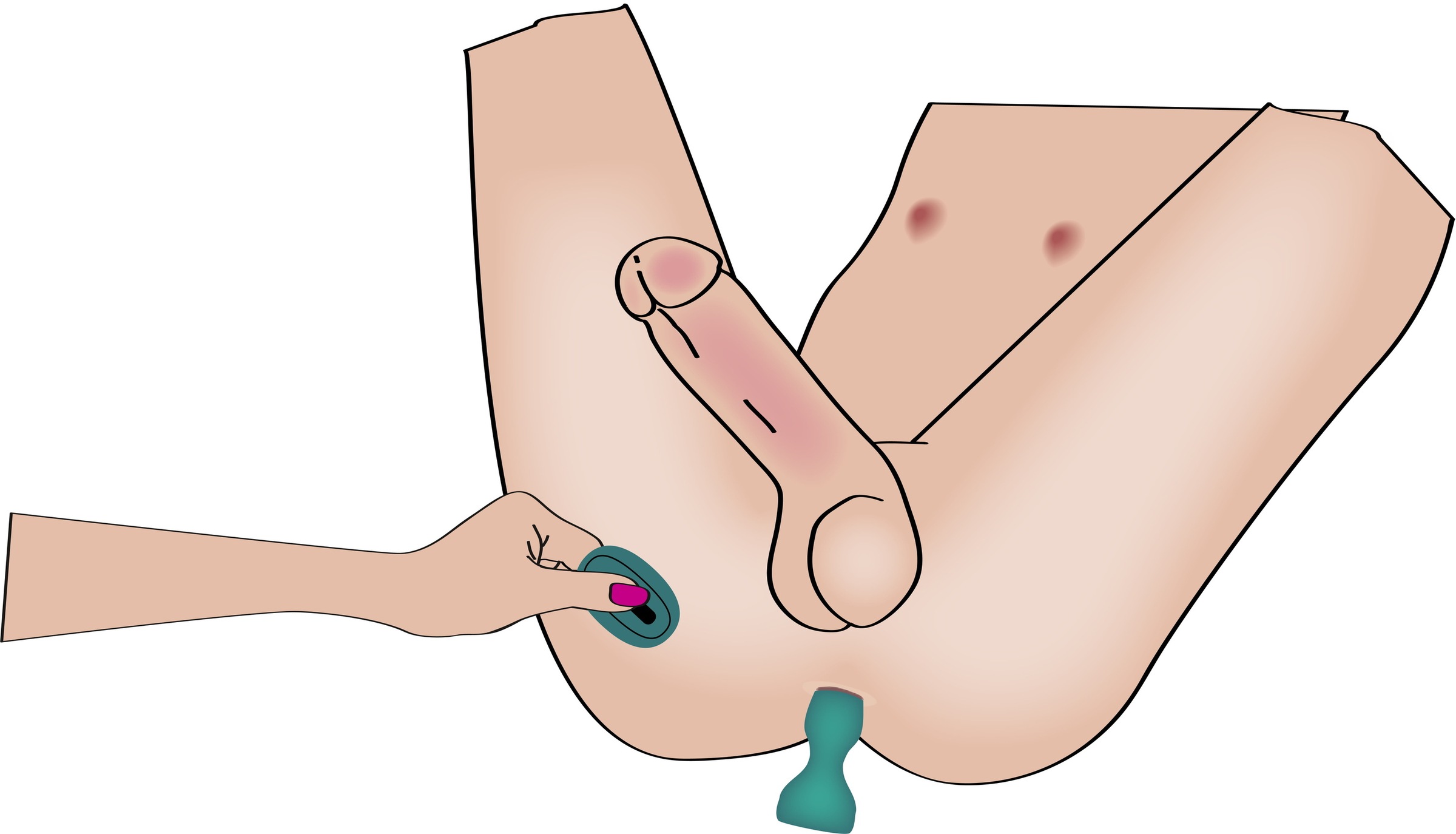 coup!es choice Vibrator »Paartoy-Set RC Mini Vibrator with 4 Attachments«