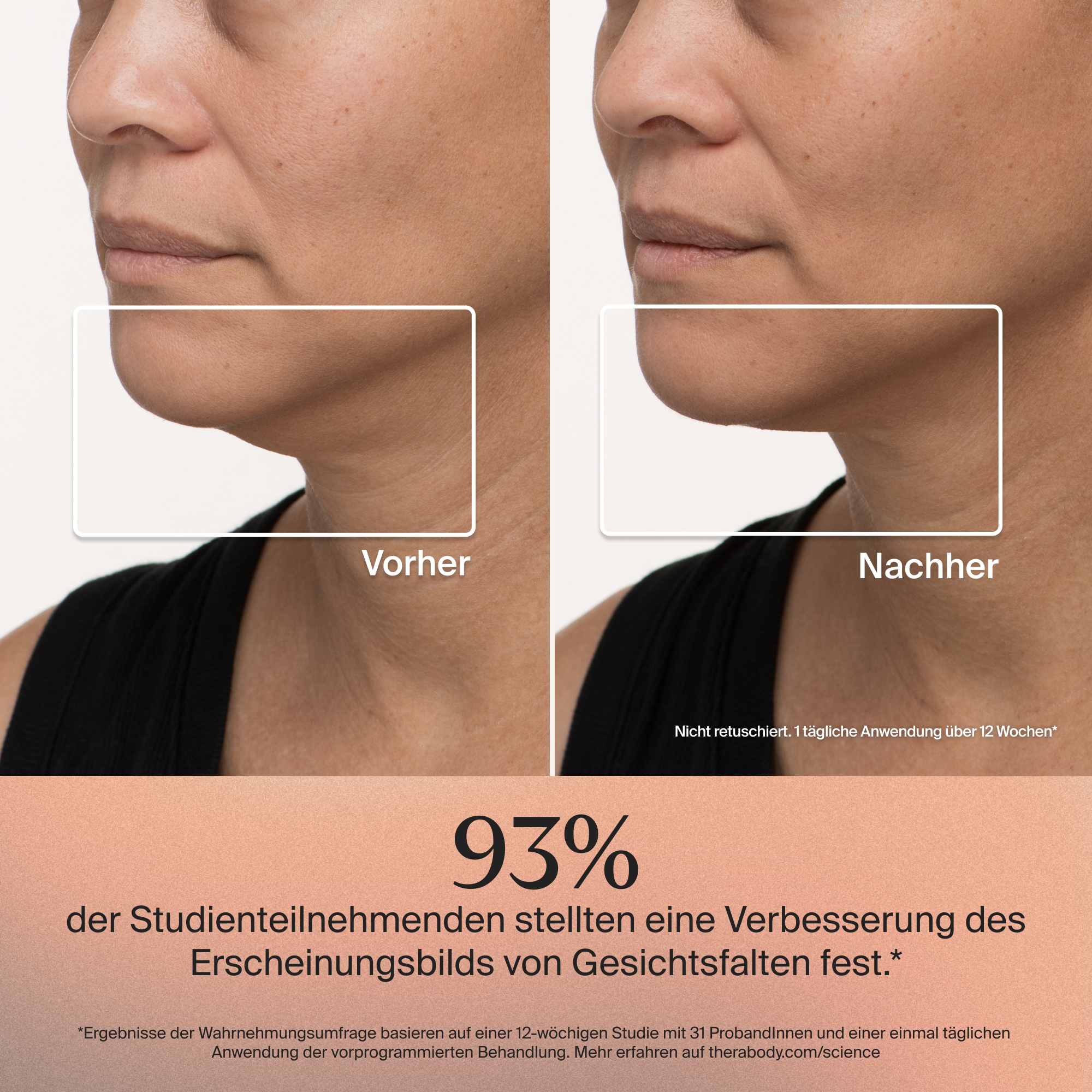 Therabody Kosmetikbehandlungsgerät »TheraFace Mask LED-Hautpflegemaske mit Vibrationstherapie«, Verbesserung der Hautstruktur, klinisch erwiesene Vorteile