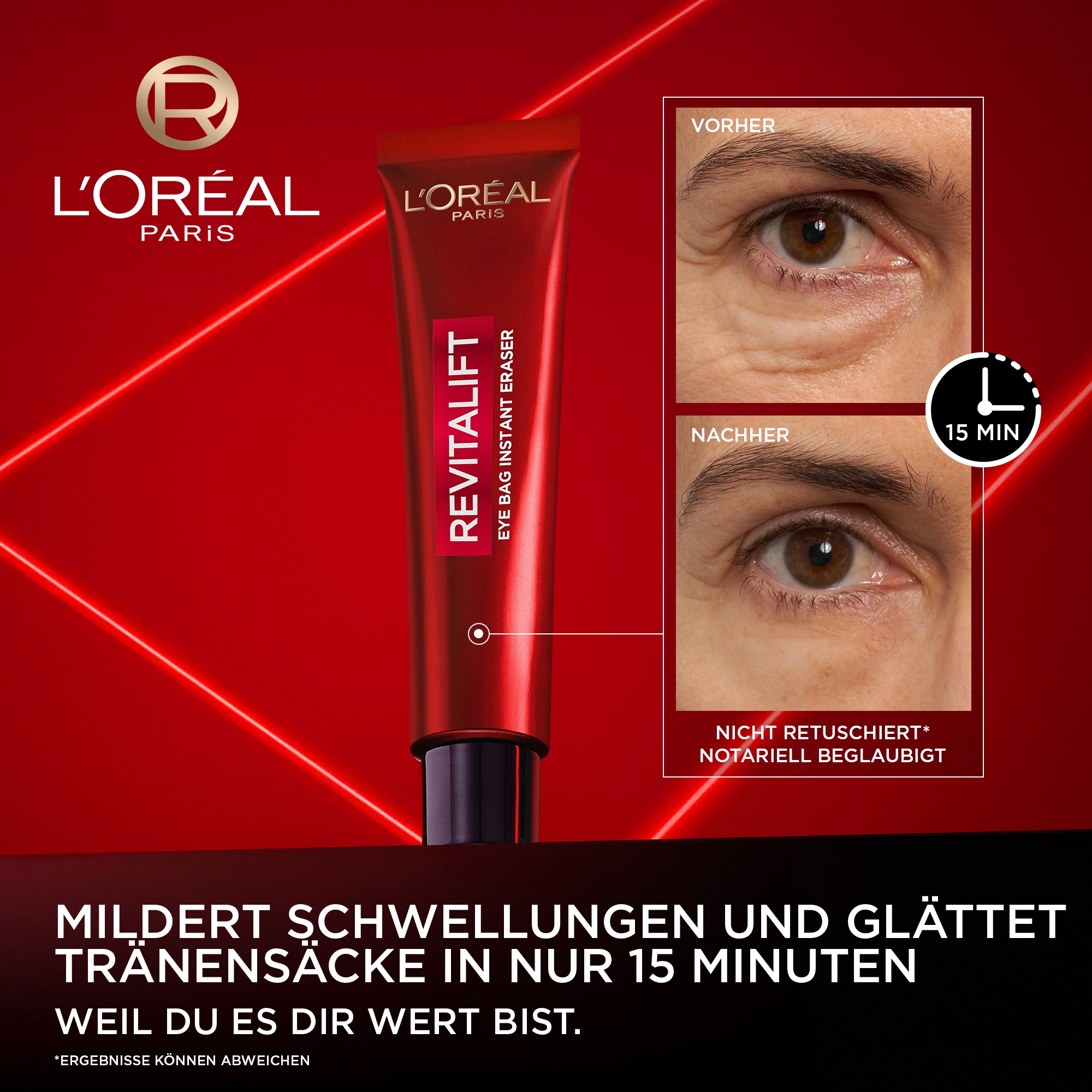 L'ORÉAL PARIS Anti-Aging-Augencreme »L'Oréal Paris Revitalift Laser Anti-Tränensack Sofort Lifting«