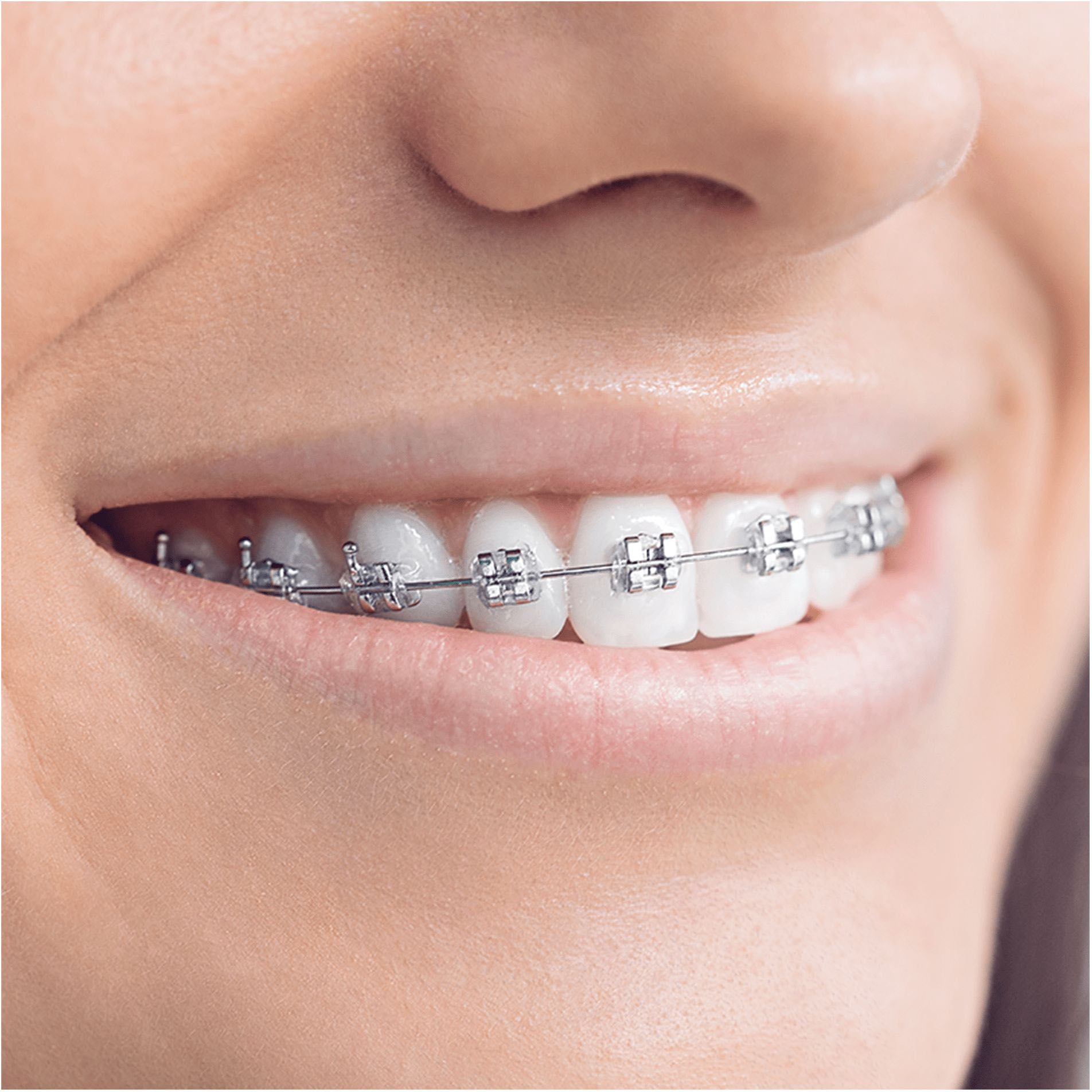 Thumbnail - Oral-B Aufsteckbürsten "Interspace"