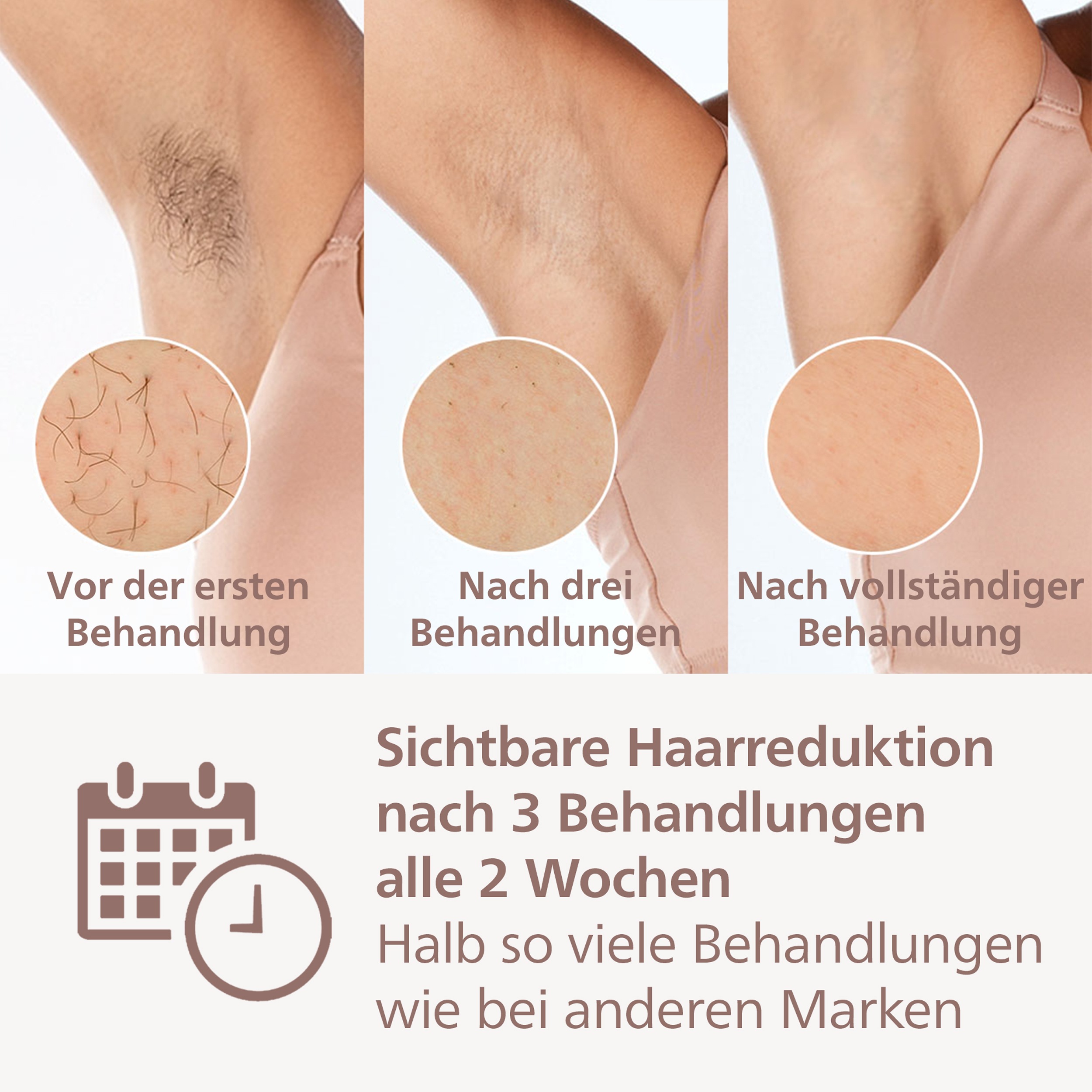 Thumbnail - Philips IPL-Haarentferner "Lumea S8000 BRI946/00" 450.000 Lichtimpulse 3 Aufsätze (Körper, Gesicht, Präzision)