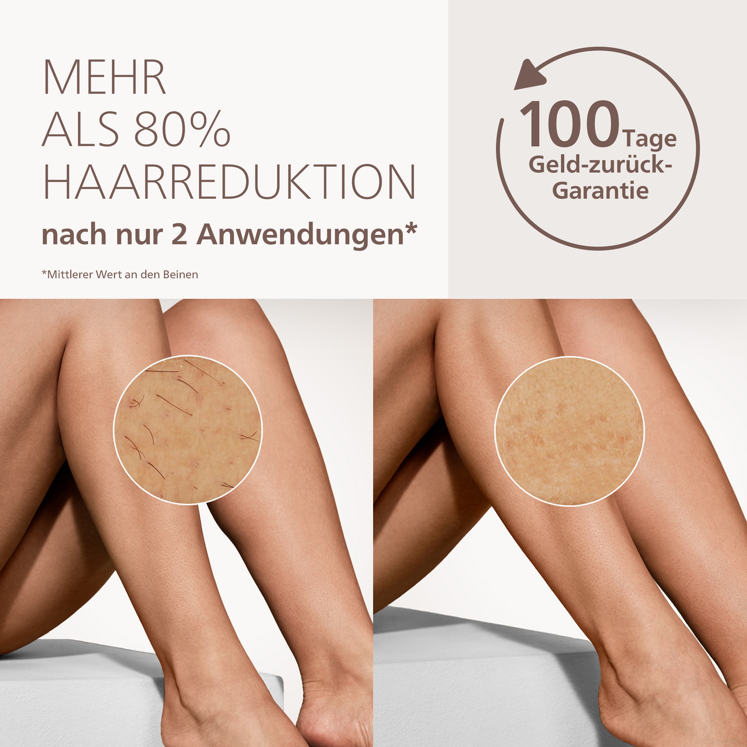 Philips Lumea IPL 7000 BRI930/00 IPL Haarentfernungsgerät mit SenseIQ, Lichtimpulstechnologie (IPL), Weiß, Hellrosa, AC, 100 - 240 V, 19.5 V - Image 3