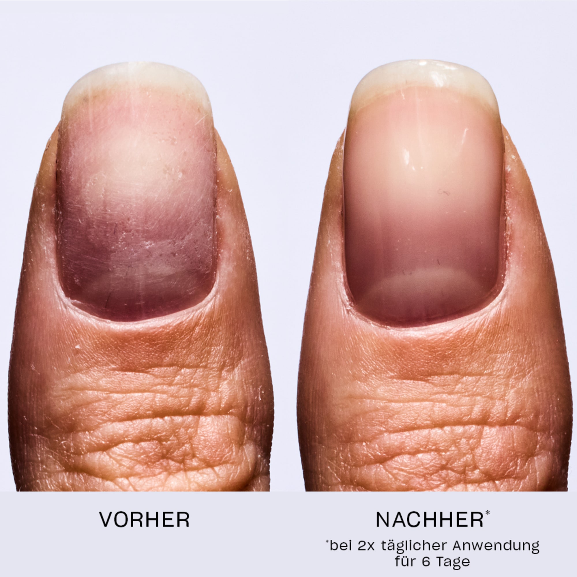 OPI Nagelpflegeserum »Repair Mode™ – Das Nagelserum« gegen brüchige Nägel, schnell einziehend, repariert, stärkt