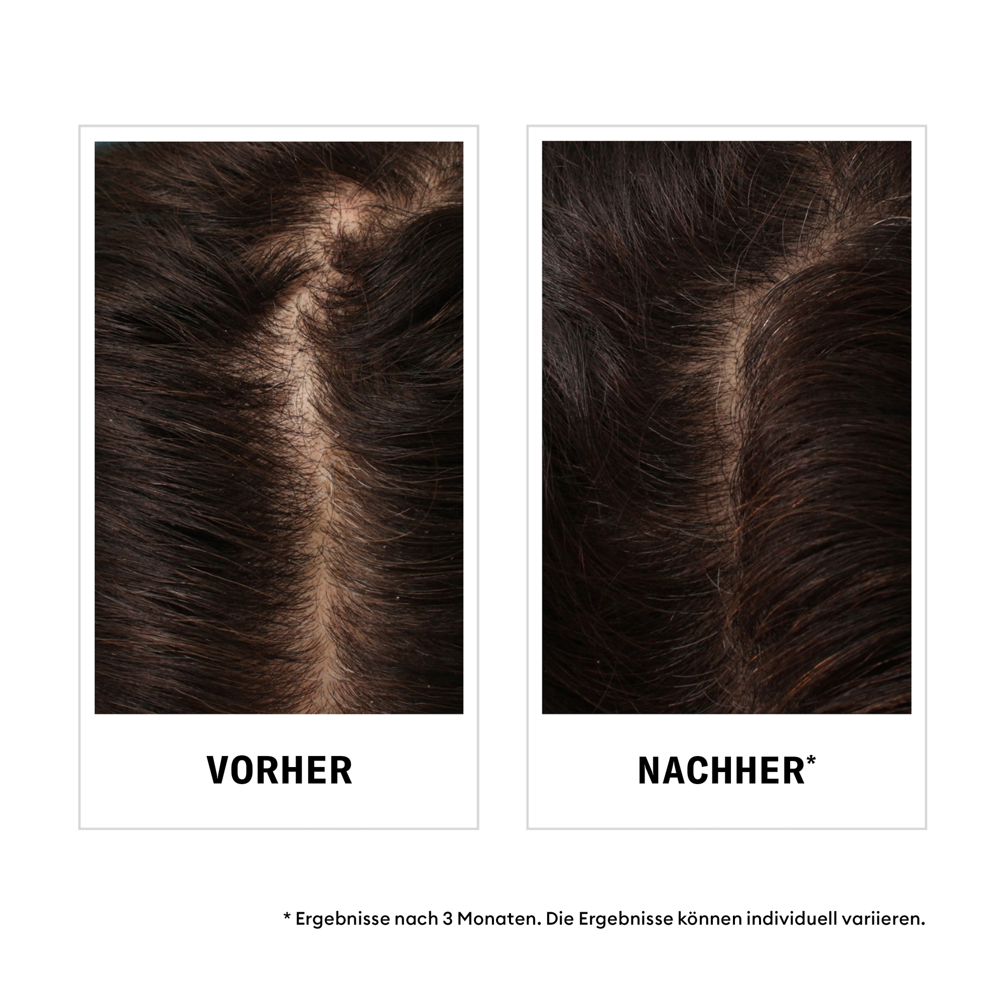 Nioxin Kopfhaut-Pflegeshampoo »NIOXIN ANTI-HAIR LOSS« nährend, pflegend, gegen Haarverlust