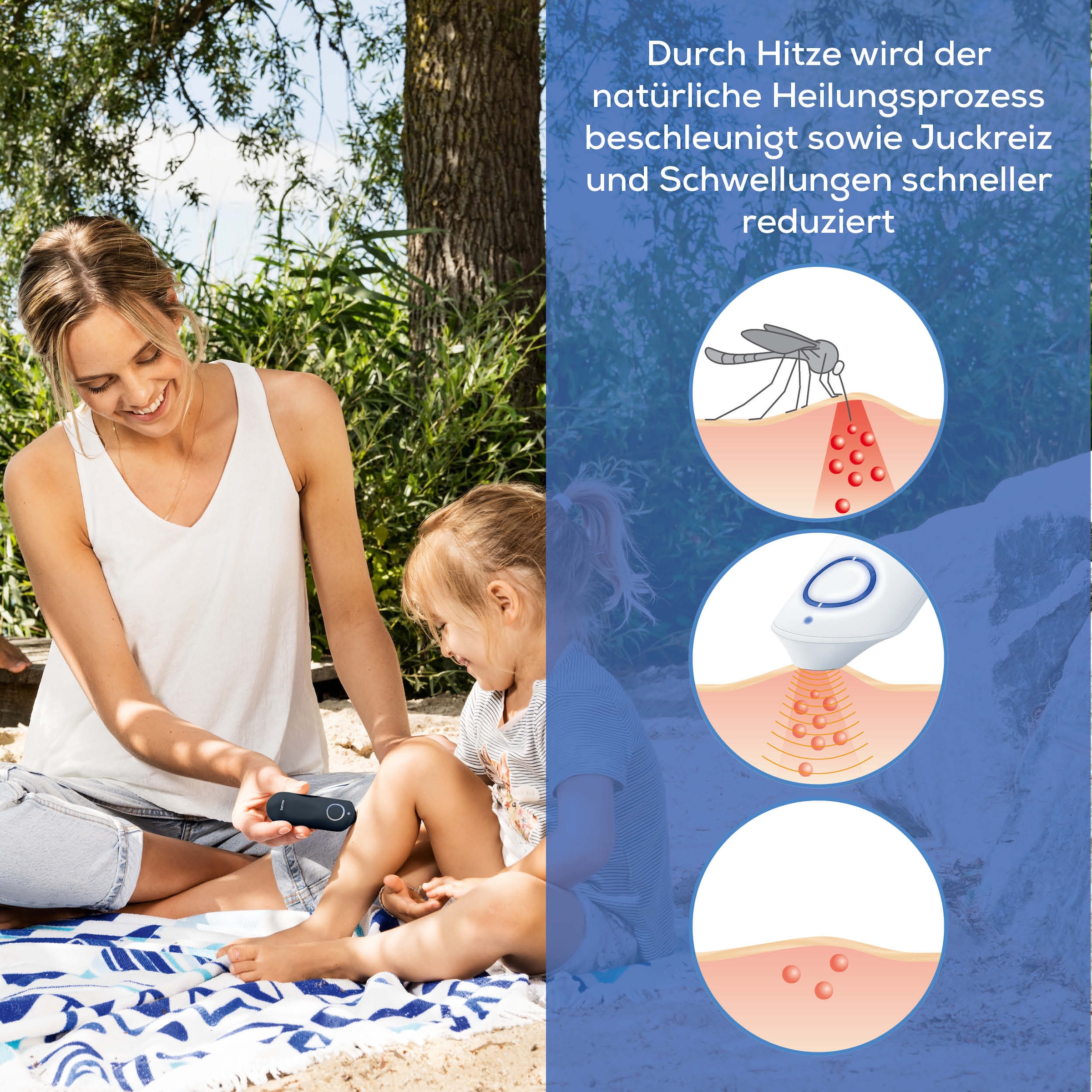 BEURER Insektenstichheiler »BR 65+ Insektenstichheiler, Behandlung von Insektenstichen- und bissen«, Kann Juckreiz lindern, ohne chemische Stoffe, klein und handlich