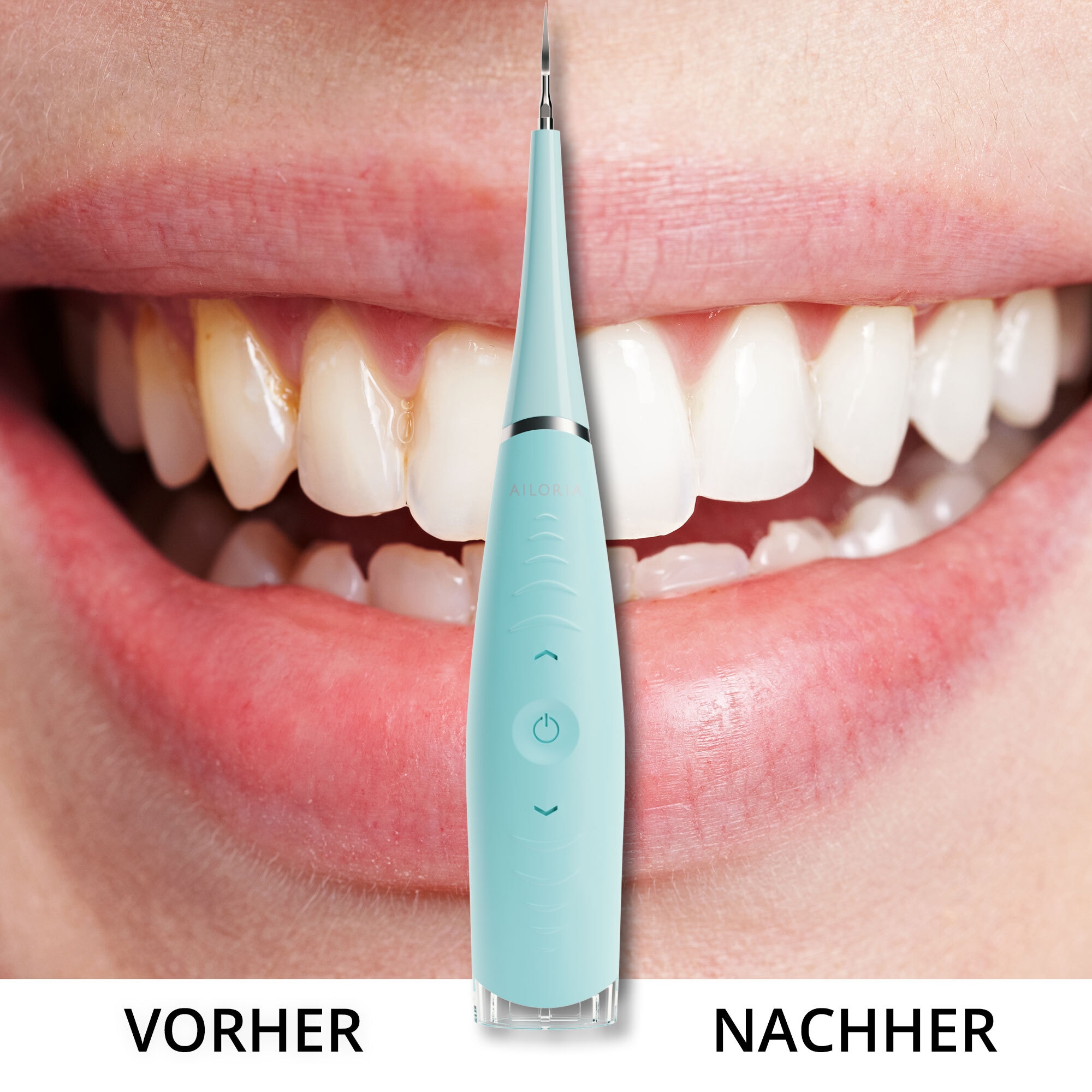 AILORIA Schall-Zahnreinigungsgerät »Schall-Zahnreiniger DEPLAQUED«