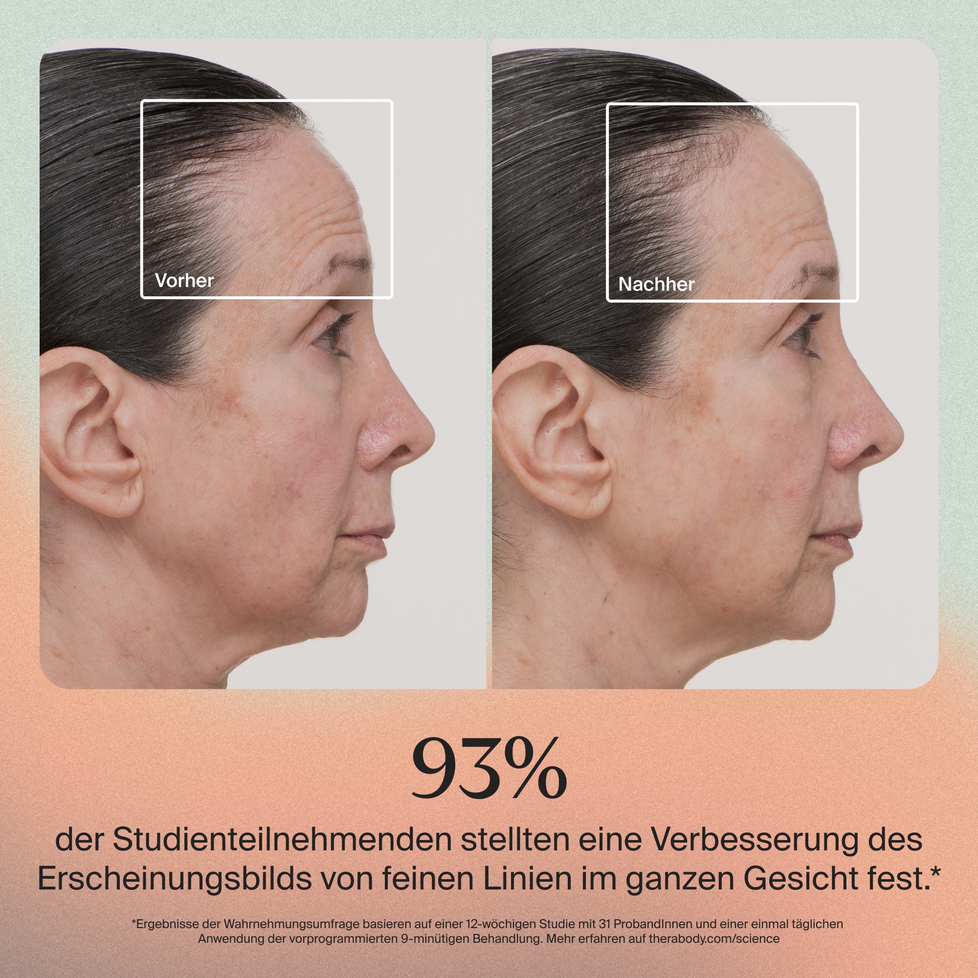 Therabody Kosmetikbehandlungsgerät »TheraFace Mask LED-Hautpflegemaske mit Vibrationstherapie«, Verbesserung der Hautstruktur, klinisch erwiesene Vorteile