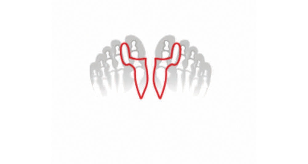 Thumbnail - Fußgut Zehenkorrektor "Hallux Korrektor mit Ballensschutz, angenehm weich aus Softgel" hält die große Zehe auf Abstand, ...