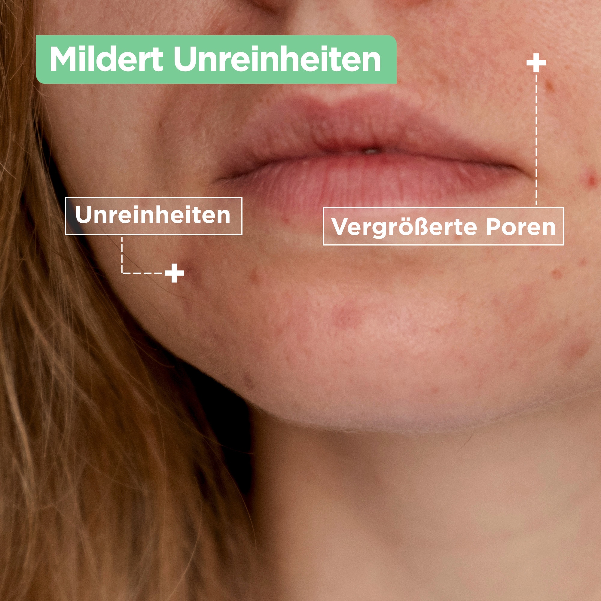 Mixa Pflegestift »Mixa Anti-Unreinheiten Comfort Cleanser«, mit hoher Wirksamkeit