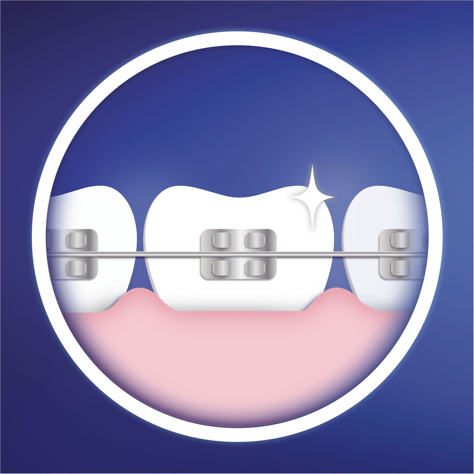 Oral-B Aufsteckbürsten »Ortho Care Essentials«