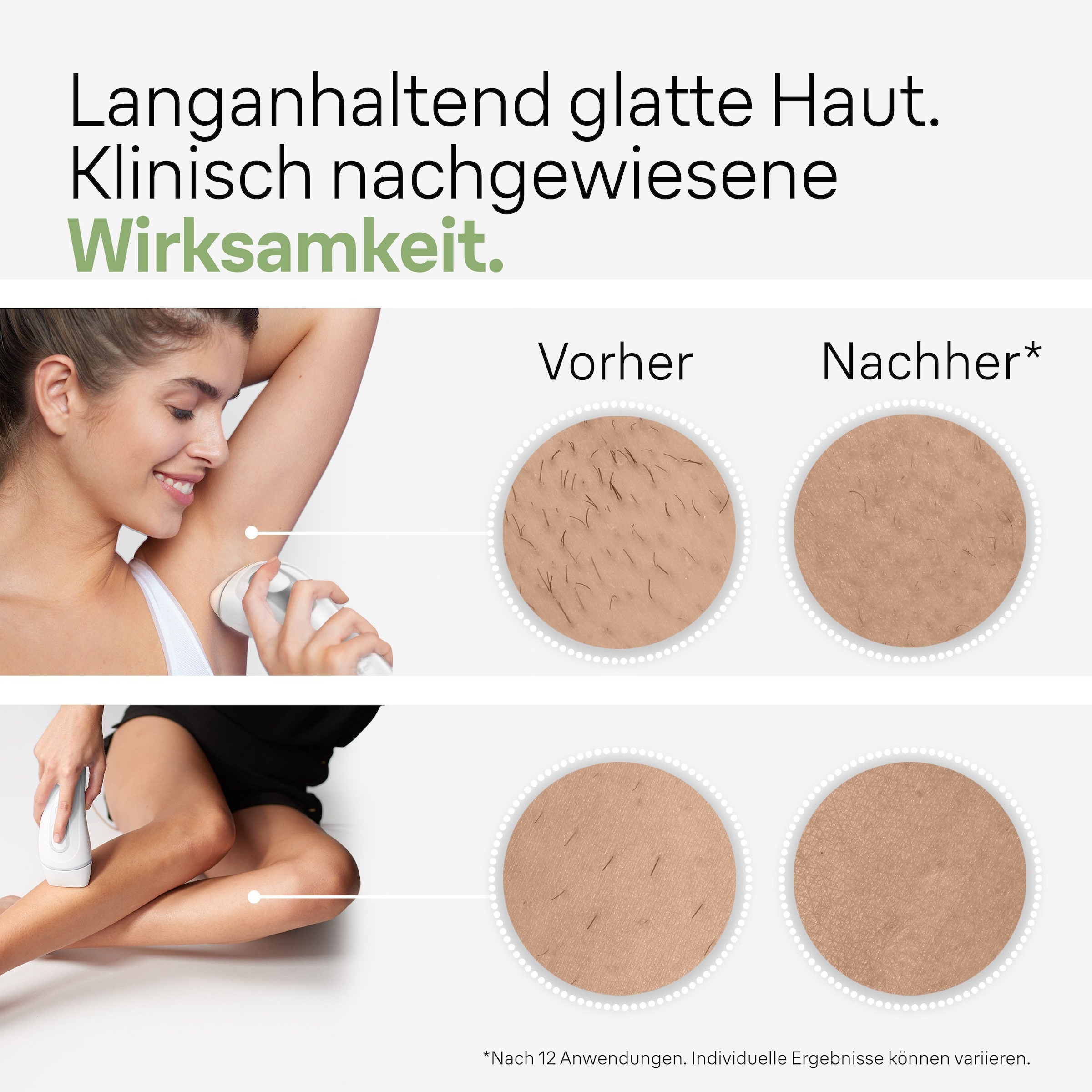 Braun IPL-Haarentferner »Silk·expert Pro 3 PL3136«, pro Minute bis zu 100 Lichtimpulse, 2 Aufsätze, Venus Rasierer, mit Aufbewahrungstasche