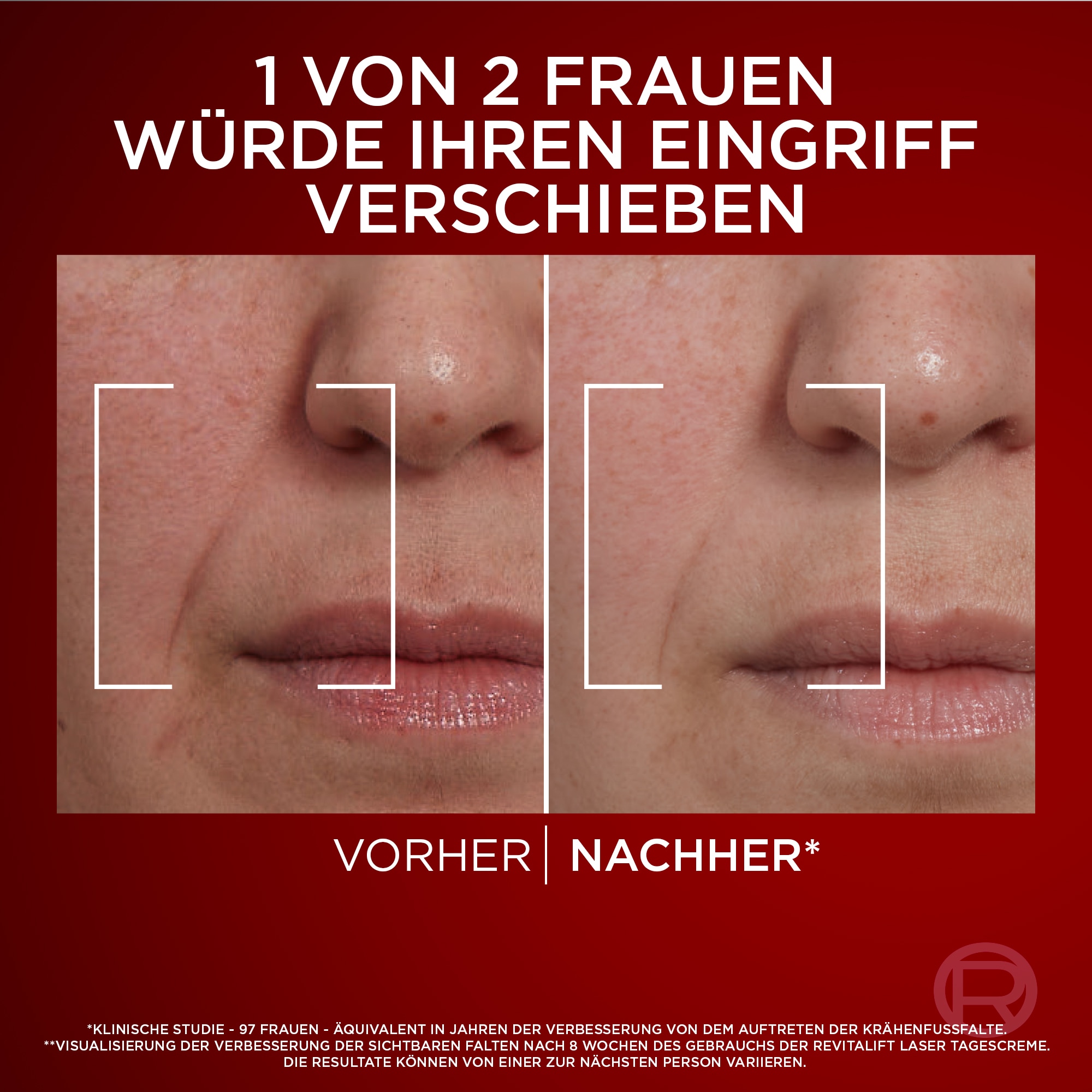 L'ORÉAL PARIS Tagescreme »REVITALIFT LASER TAGESCREME« mildert Falten, strafft und verfeinert die Haut