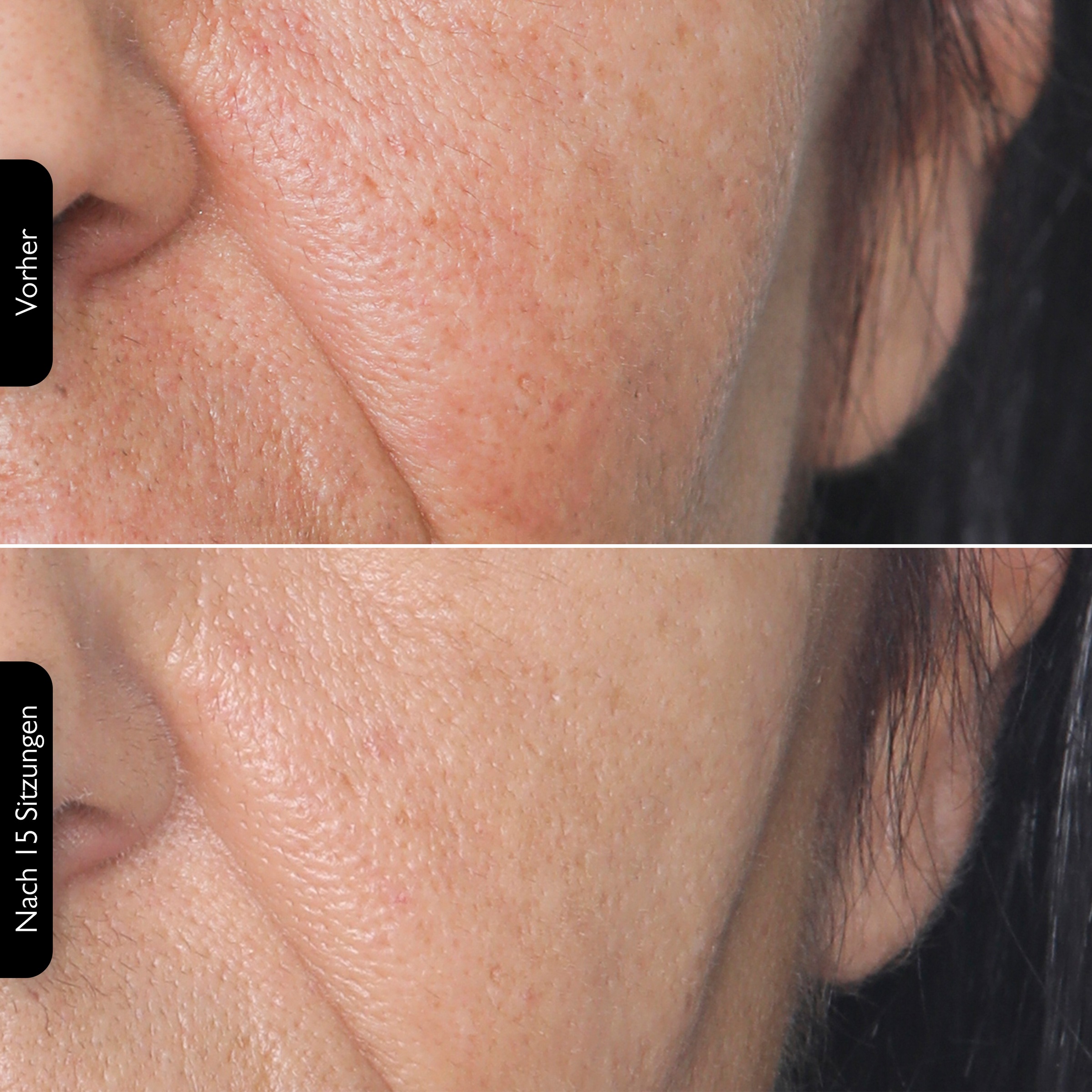 Silk'n Anti-Aging-Gerät »FaceTite Multiplatform«, Multifunktionsfähig