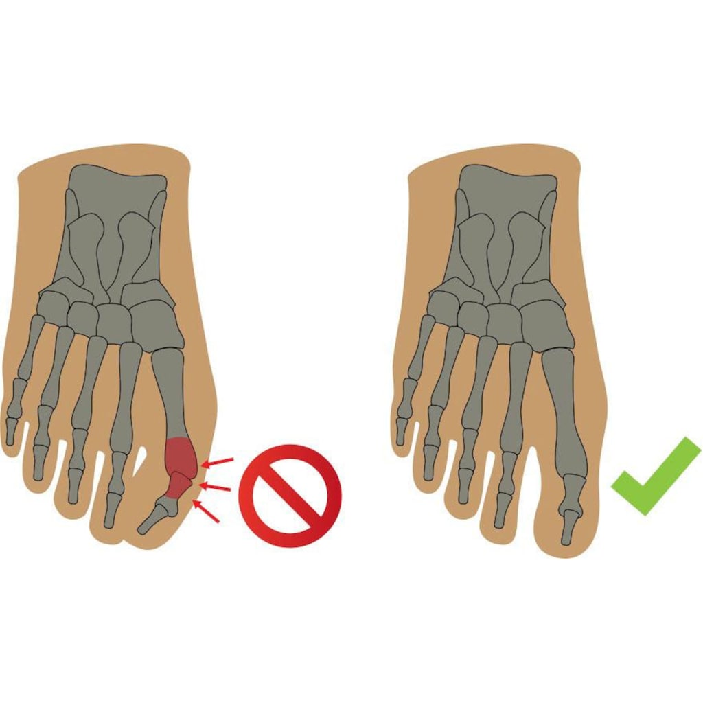 Fußgut Überbeinschutz, mit Gelpolster, lindert Schmerzen bei Hallux Valgus