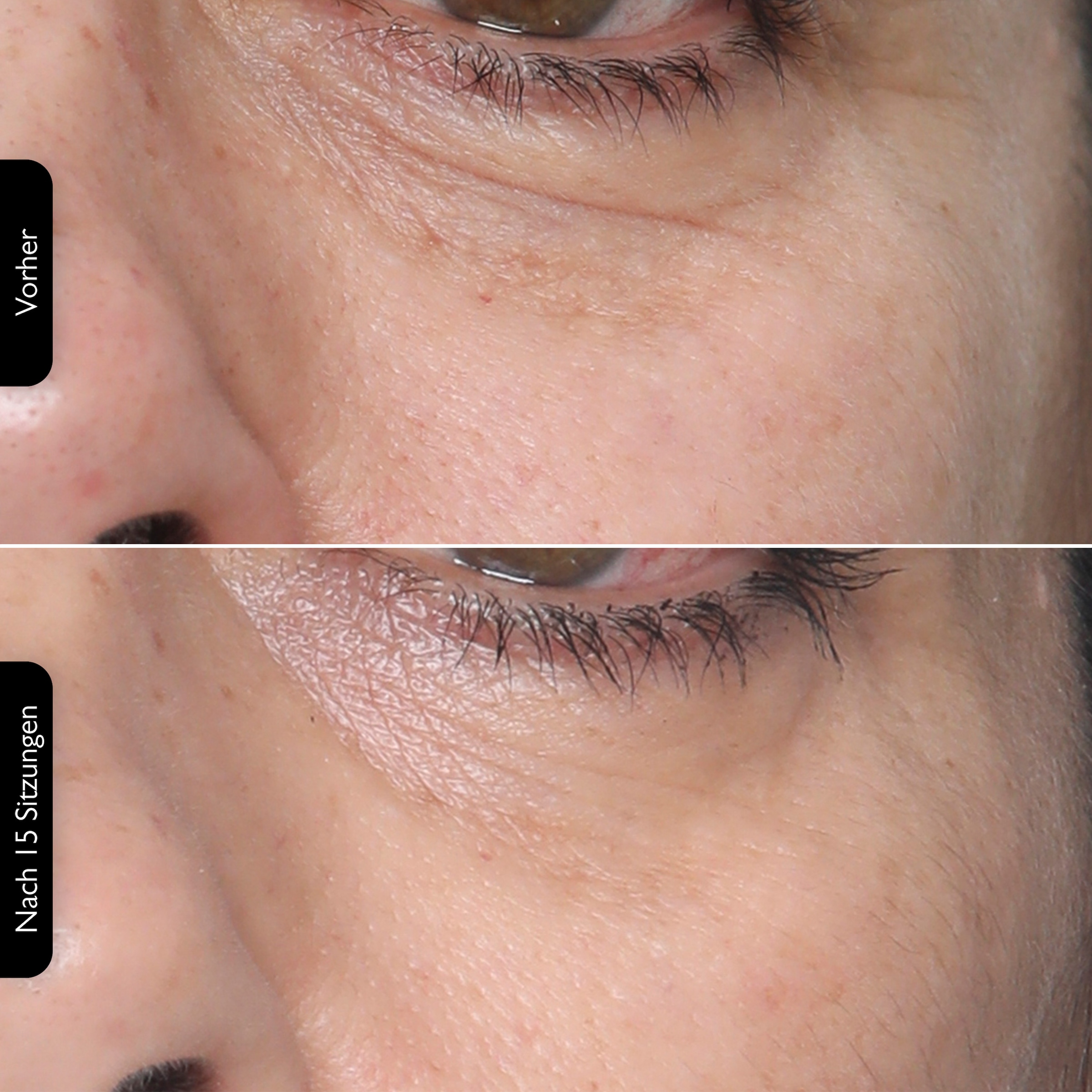 Silk'n Anti-Aging-Gerät »FaceTite Multiplatform«, Multifunktionsfähig