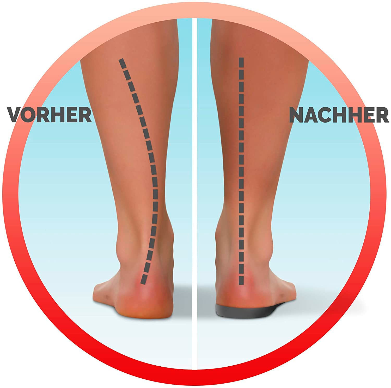 scholl einlegesohlen bei fersenschmerzen