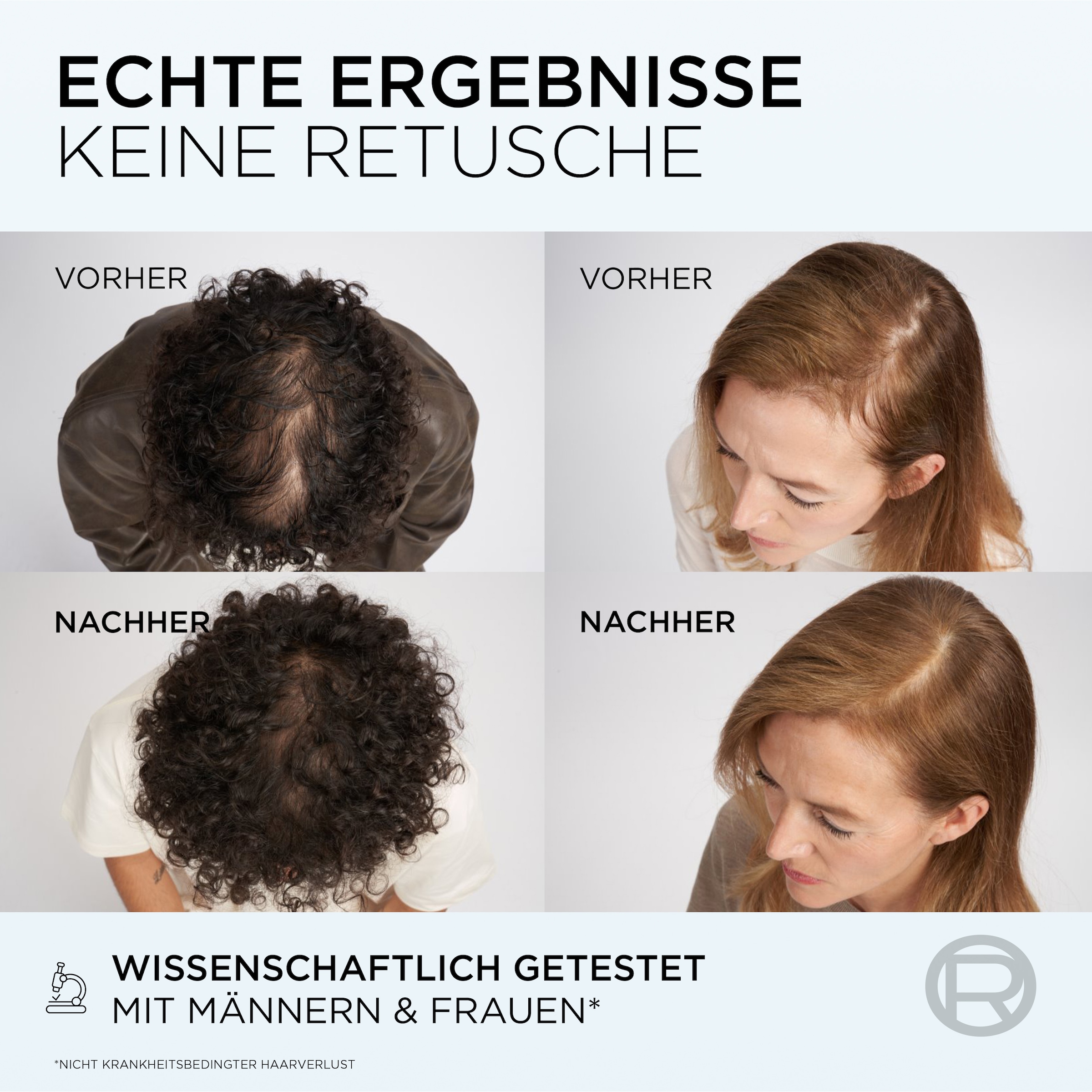 L'ORÉAL PARIS Haarserum »L'Oréal Paris Elvital Fiber Booster Serum«
