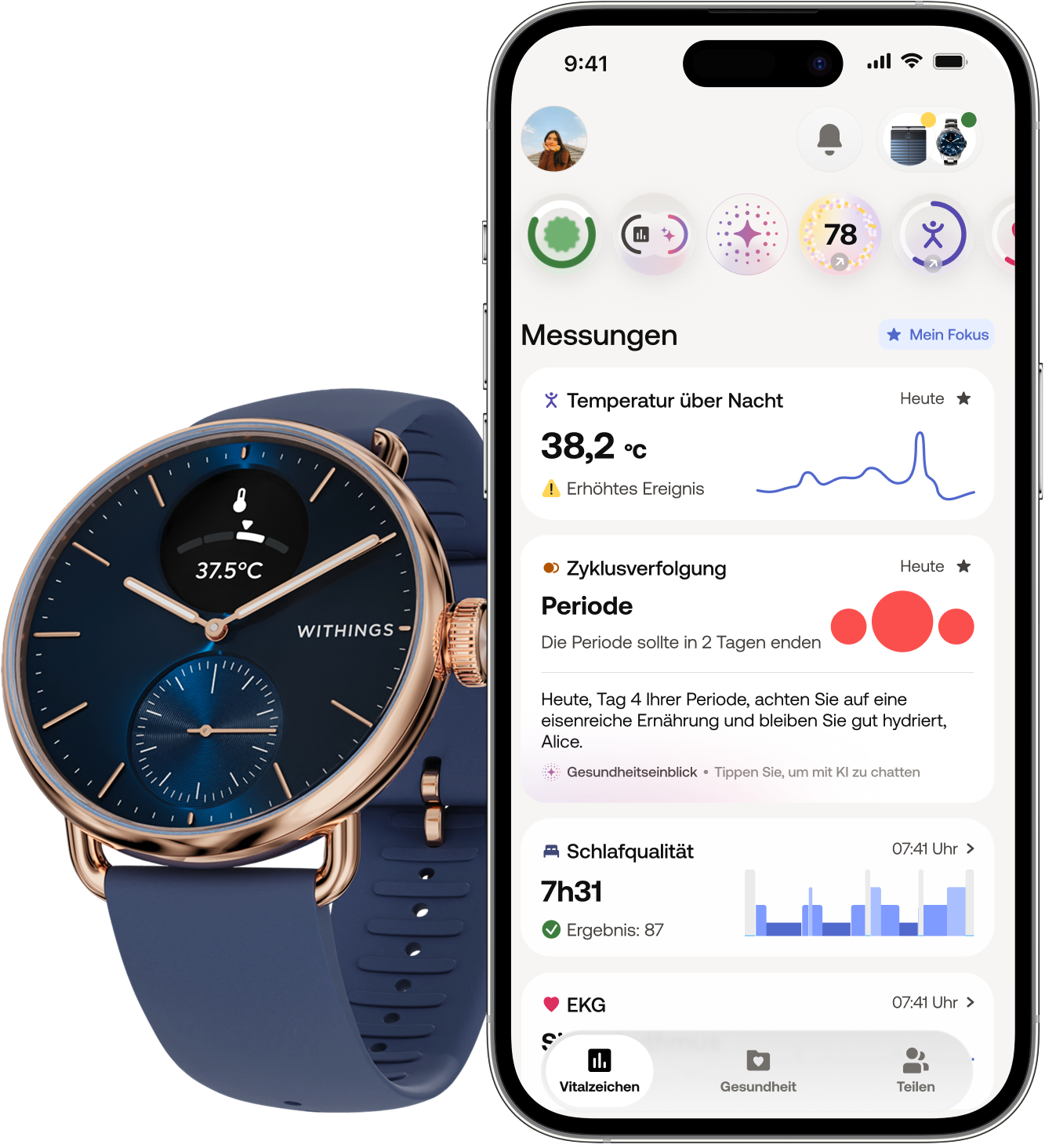 Withings Smartwatch »ScanWatch 2 38mm Rose Gold Blue« ( )
