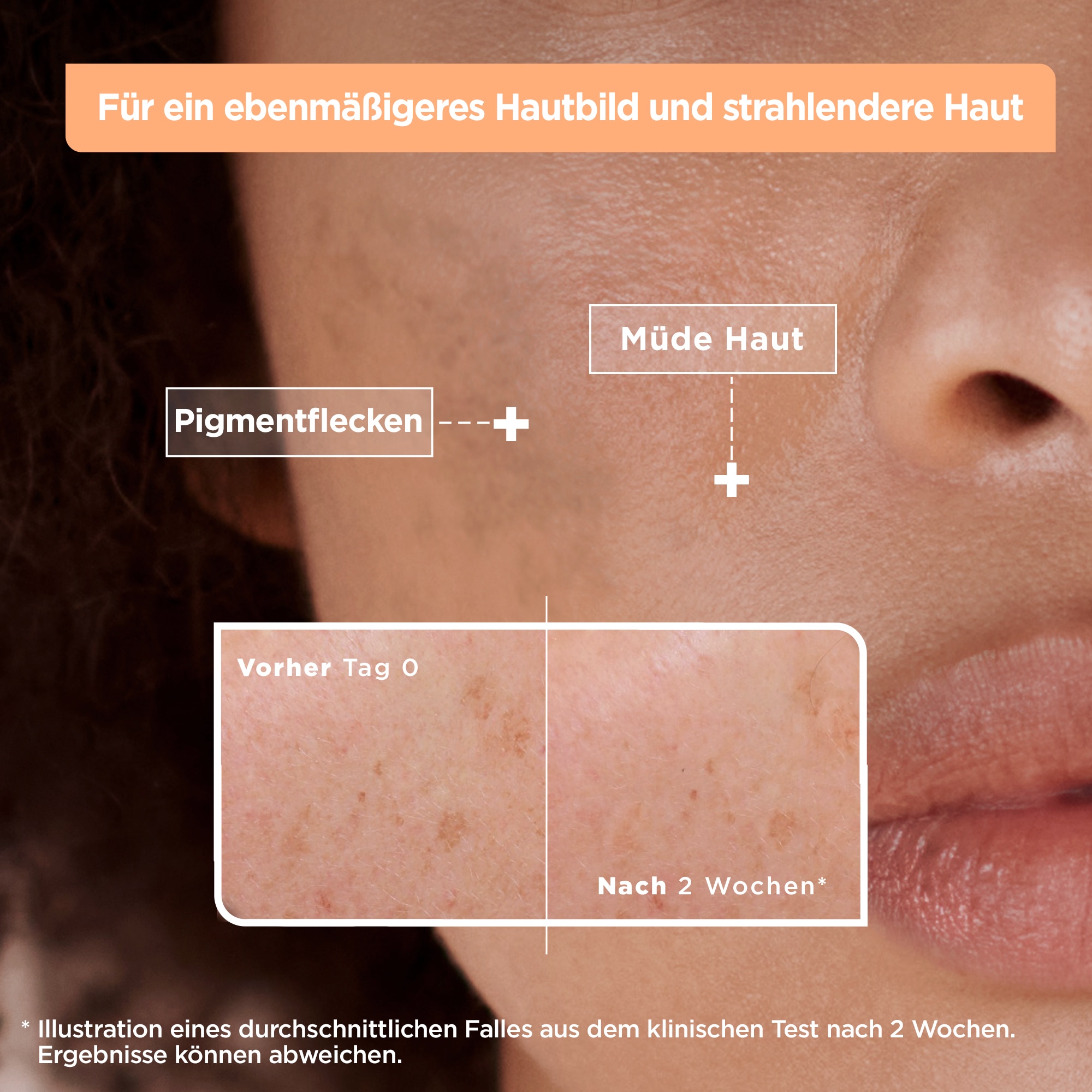 Mixa Gesichtsserum »Mixa Anti-Pigmentflecken Serum«, mit hoher Wirksamkeit